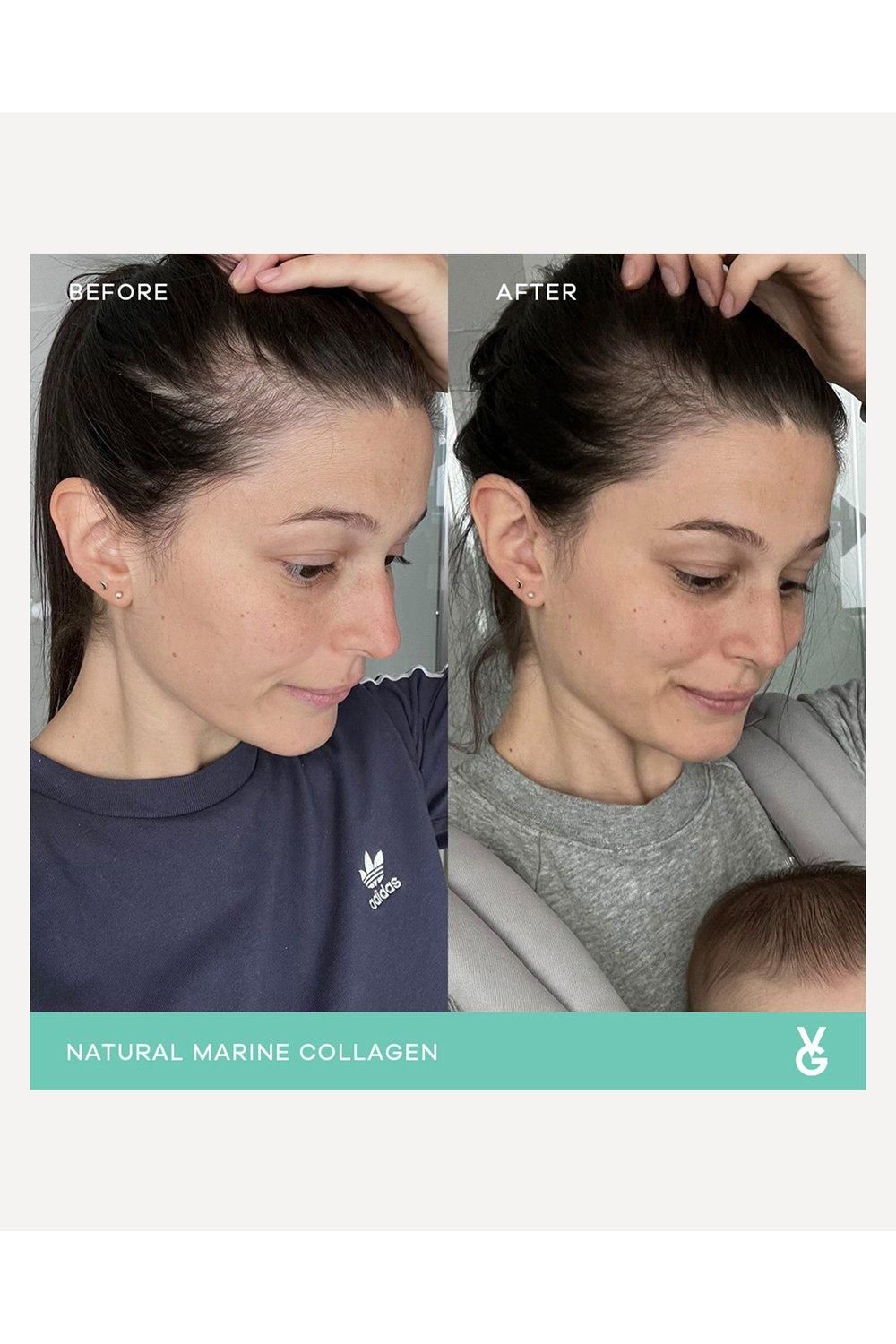 Vida Glow Natural Marine Collagen Sachets Mango Multi image 4