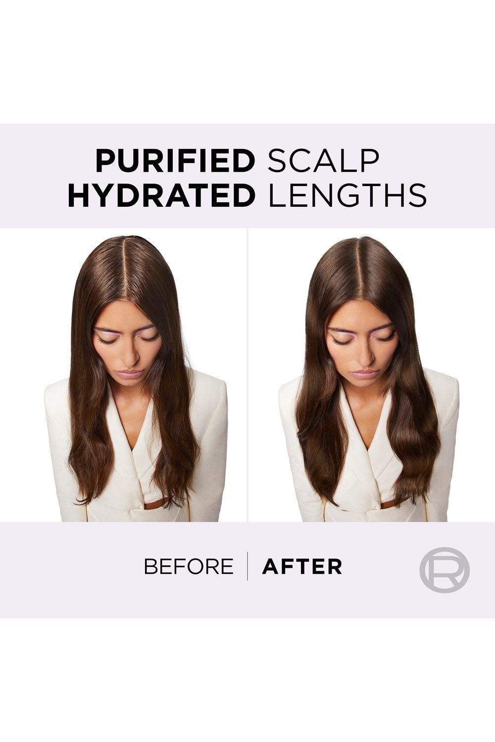 L'Oréal Paris Elvive Hydra Pure Exfoliating Pre-Shampoo Scalp Serum with Salicylic Acid, for Oily Scalp & Roots Multi image 3