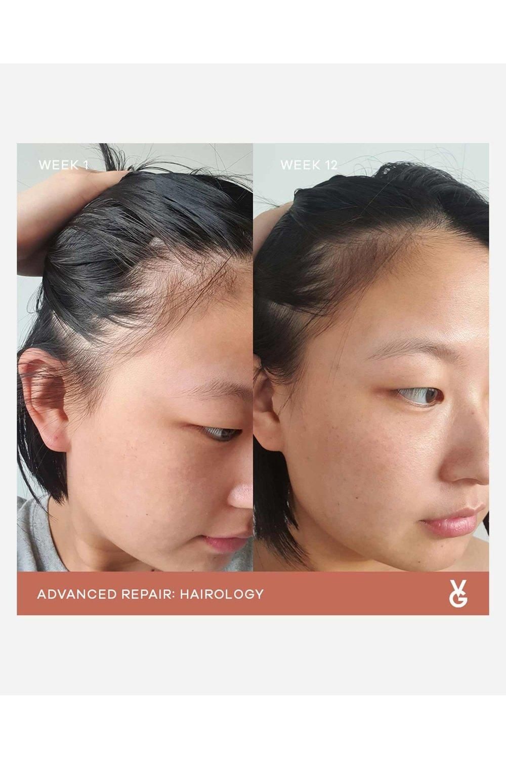 Vida Glow Hairology Multi image 4