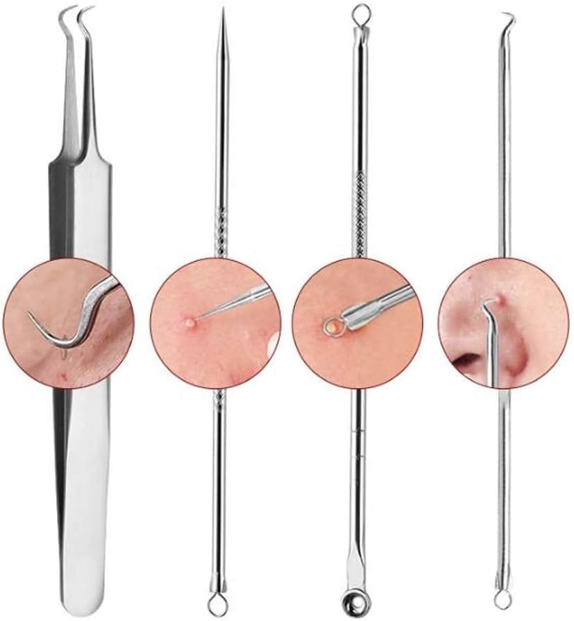 KAV Comedone Extractor Kit 5-Piece Blackhead Remover Tool Set with Storage Case image 6
