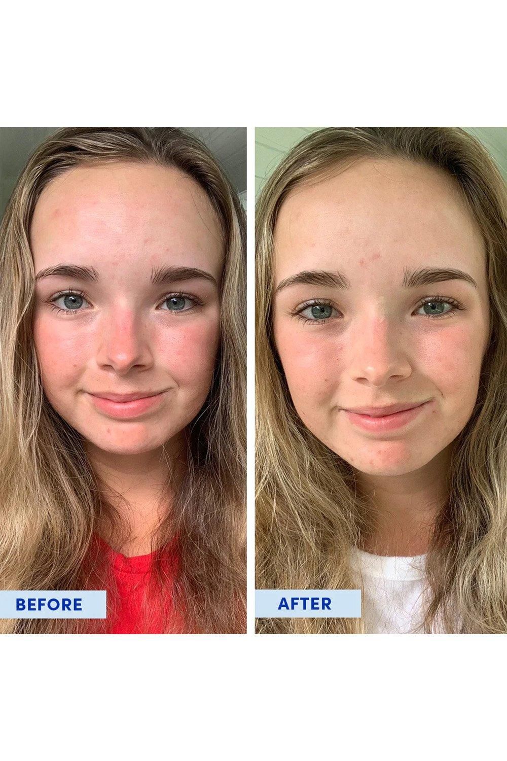 Sand & Sky Tasmanian Spring Water - Splash Serum 30ml Multi image 4