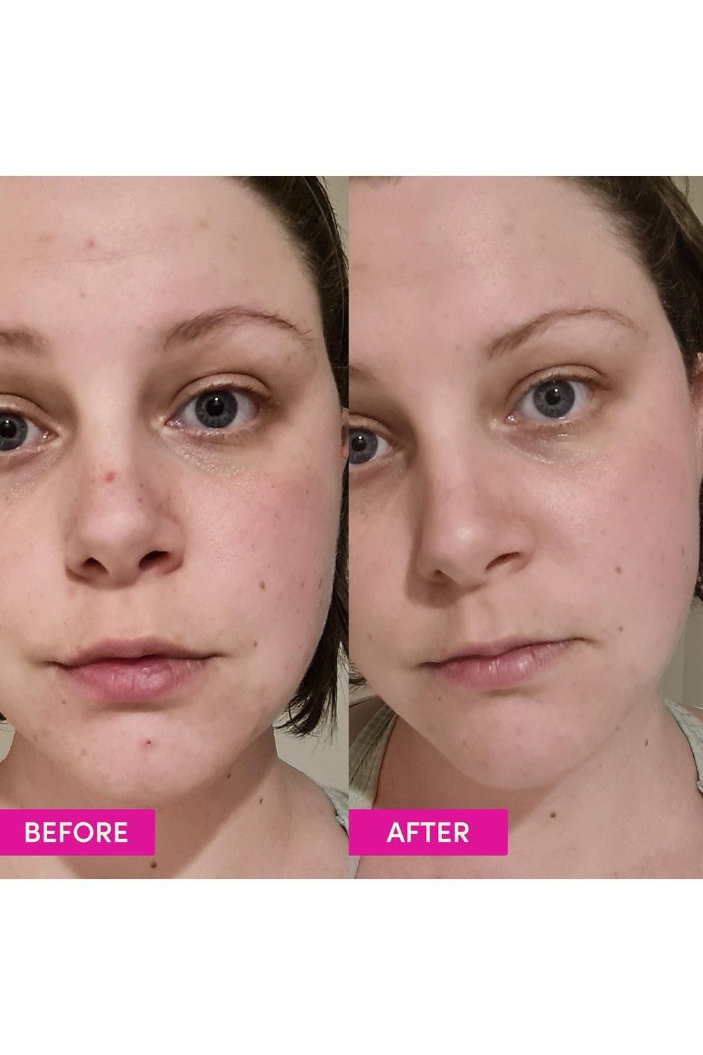 Sand & Sky Australian Glow Berries - Intense Glow Moisturiser 60g Multi image 5