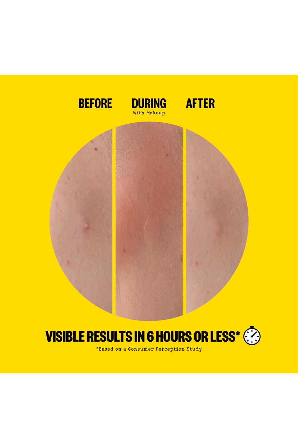 Peace Out Acne Day Dot - 20 Dots Multi image 7