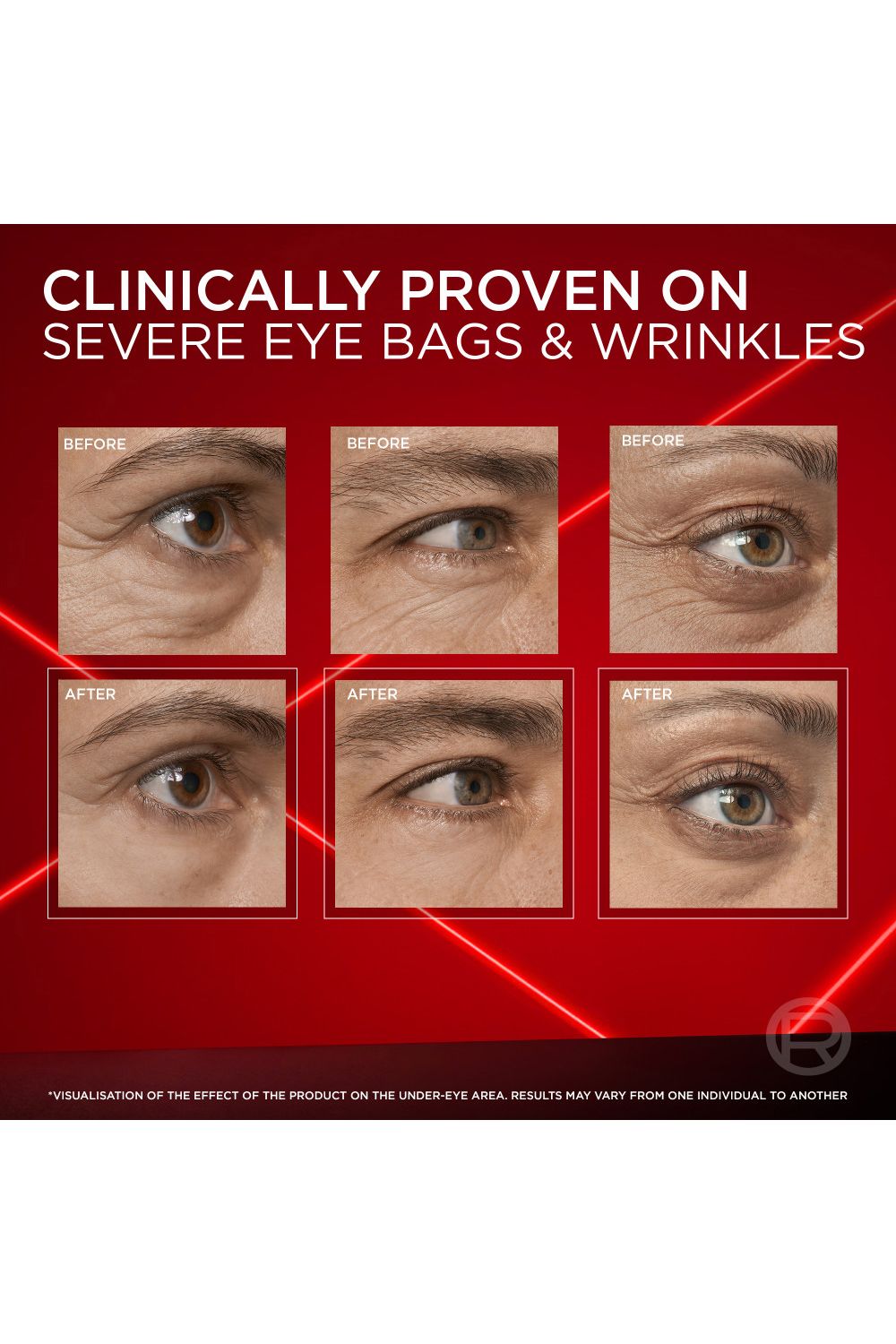 L'Oréal Paris Revitalift Laser Instant Eye Bag Eraser 15ml Multi image 7