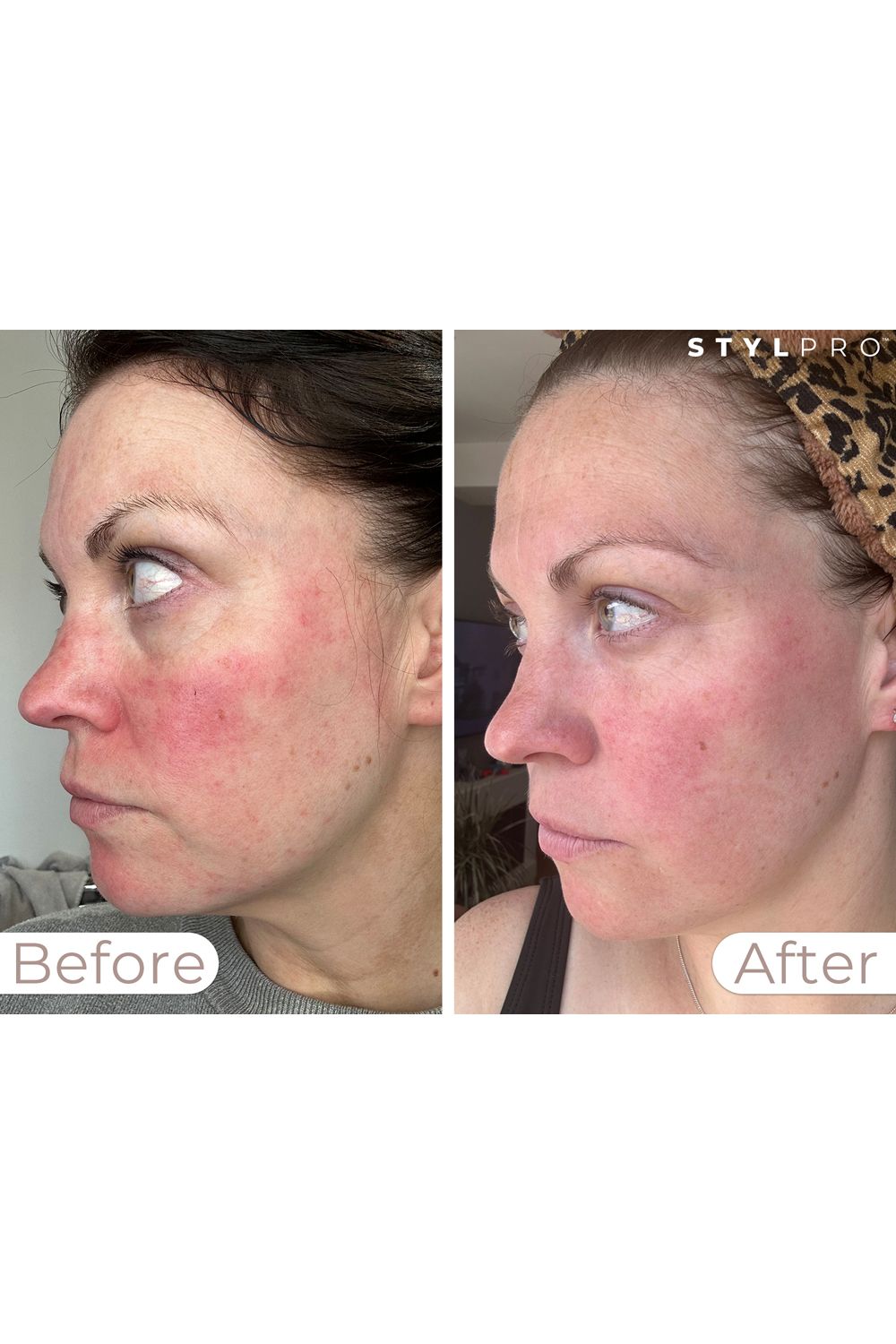 Stylpro LED Wavelength Face Mask Multi image 8