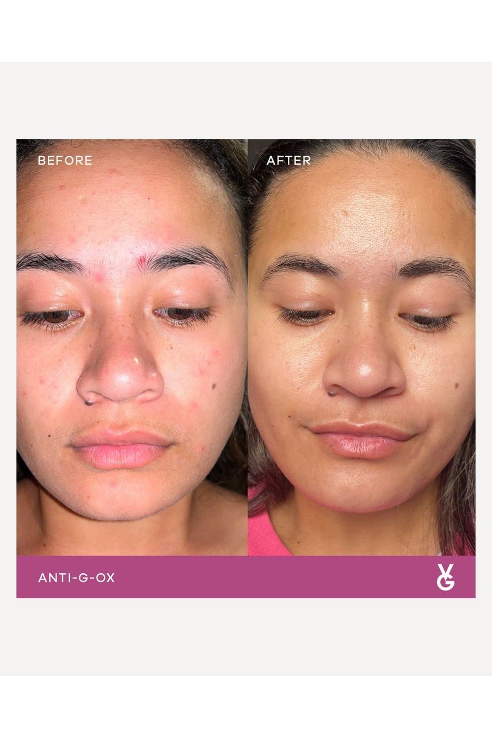 Vida Glow Anti-G-Ox Starter Pack Multi image 4