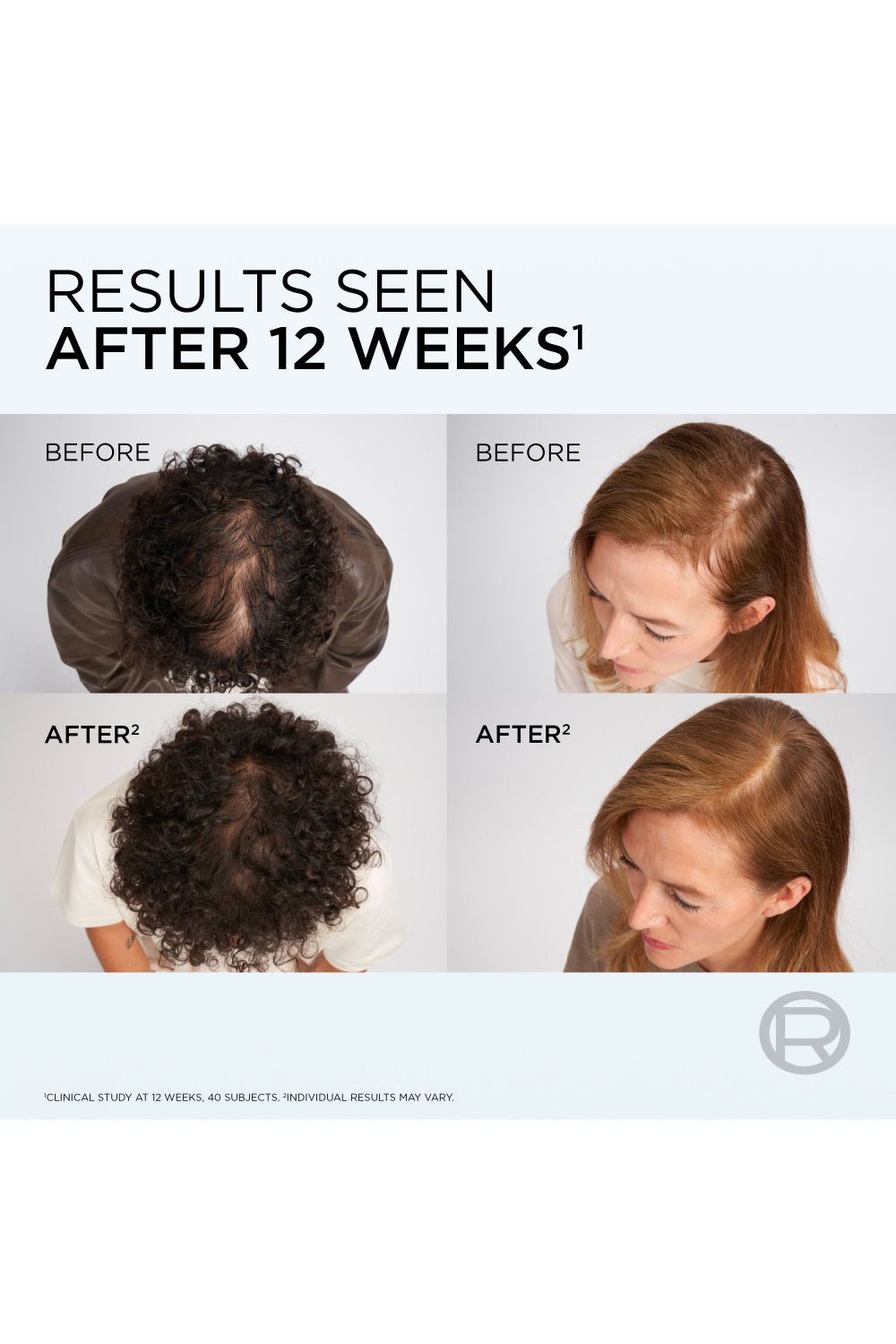 L'Oréal Paris Elvive Growth Booster Scalp Serum, Anti Hair Loss Scalp Treatment, 102ml Multi image 5