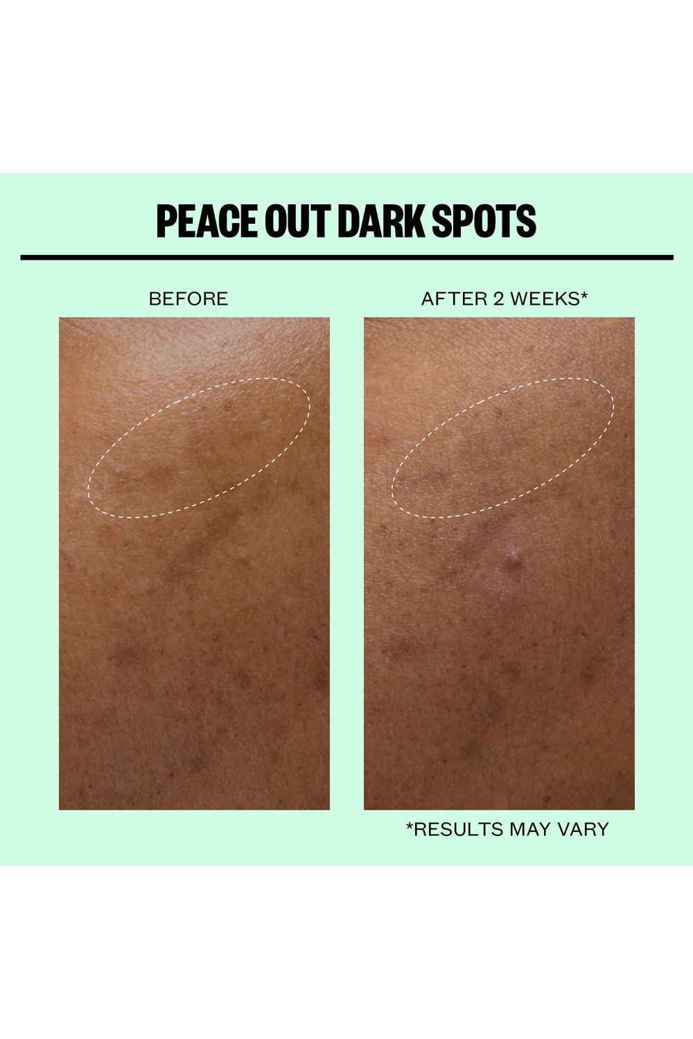 Peace Out Dark Spots - 12 Dots Multi image 8