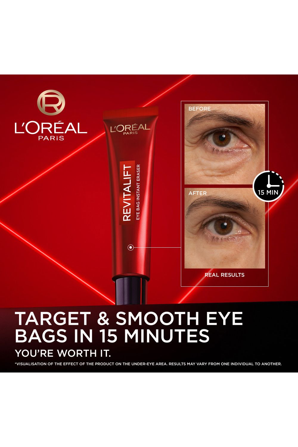 L'Oréal Paris Revitalift Laser Instant Eye Bag Eraser 15ml Multi image 2