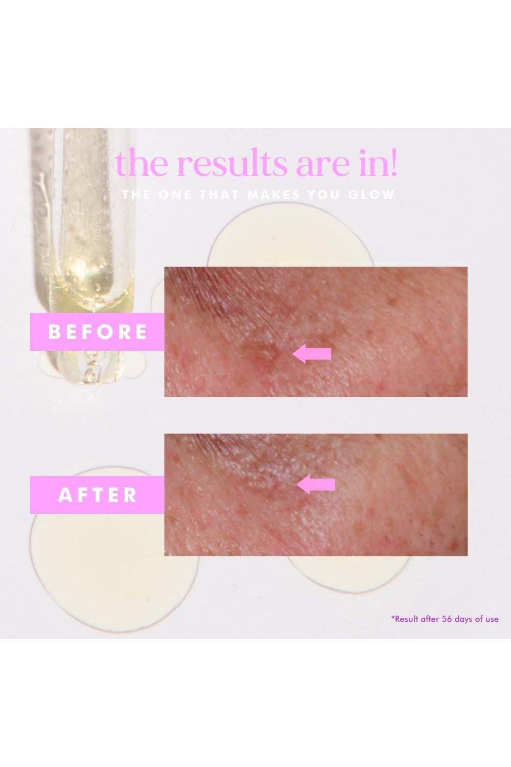 Hellosunday The One That Makes You Glow - SPF40 Hyperpigmentation Treatment Serum Multi image 5