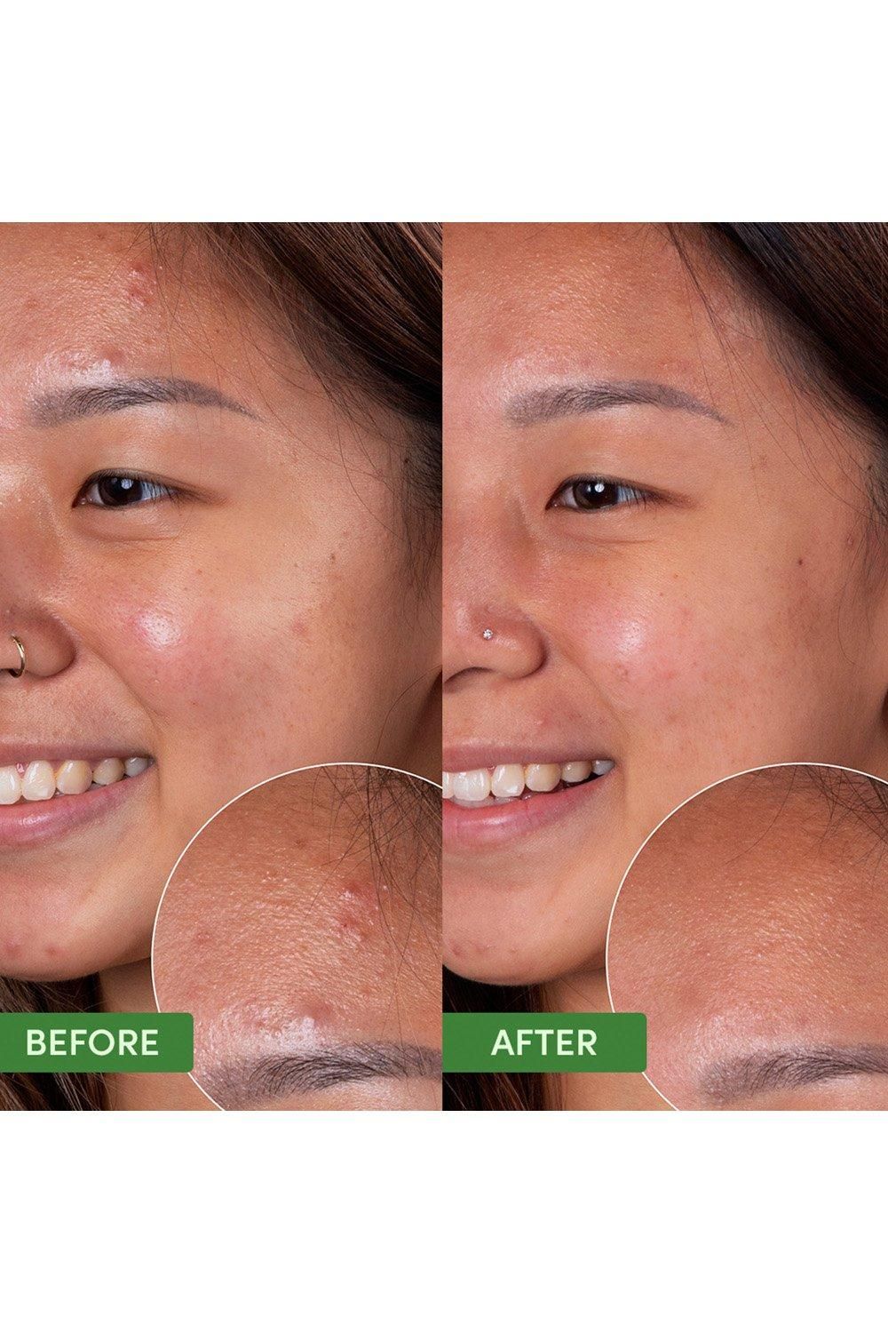 Sand & Sky Oil Control - Clearing Face Mask 100g Multi image 4