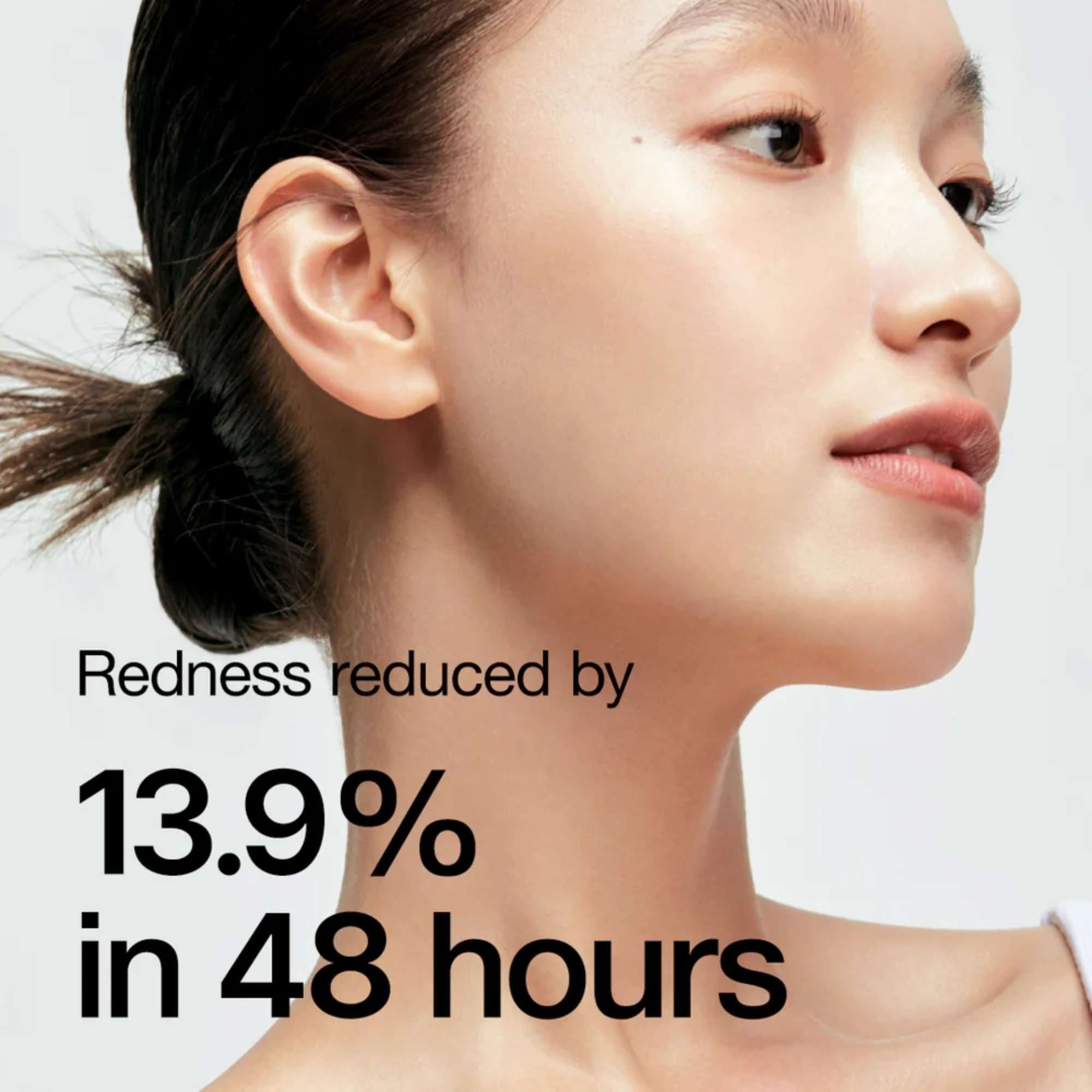 Anua Heartleaf 77% Soothing Toner 250ml image 4