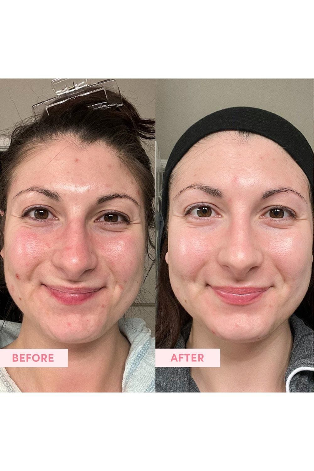 Sand & Sky Marshmallow Pink Toner 120ml Multi image 4