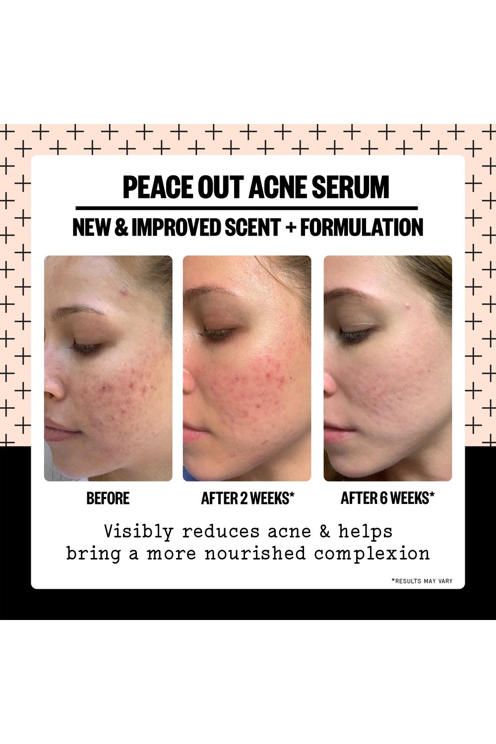 Peace Out Acne Cleanser 50ml Multi image 7