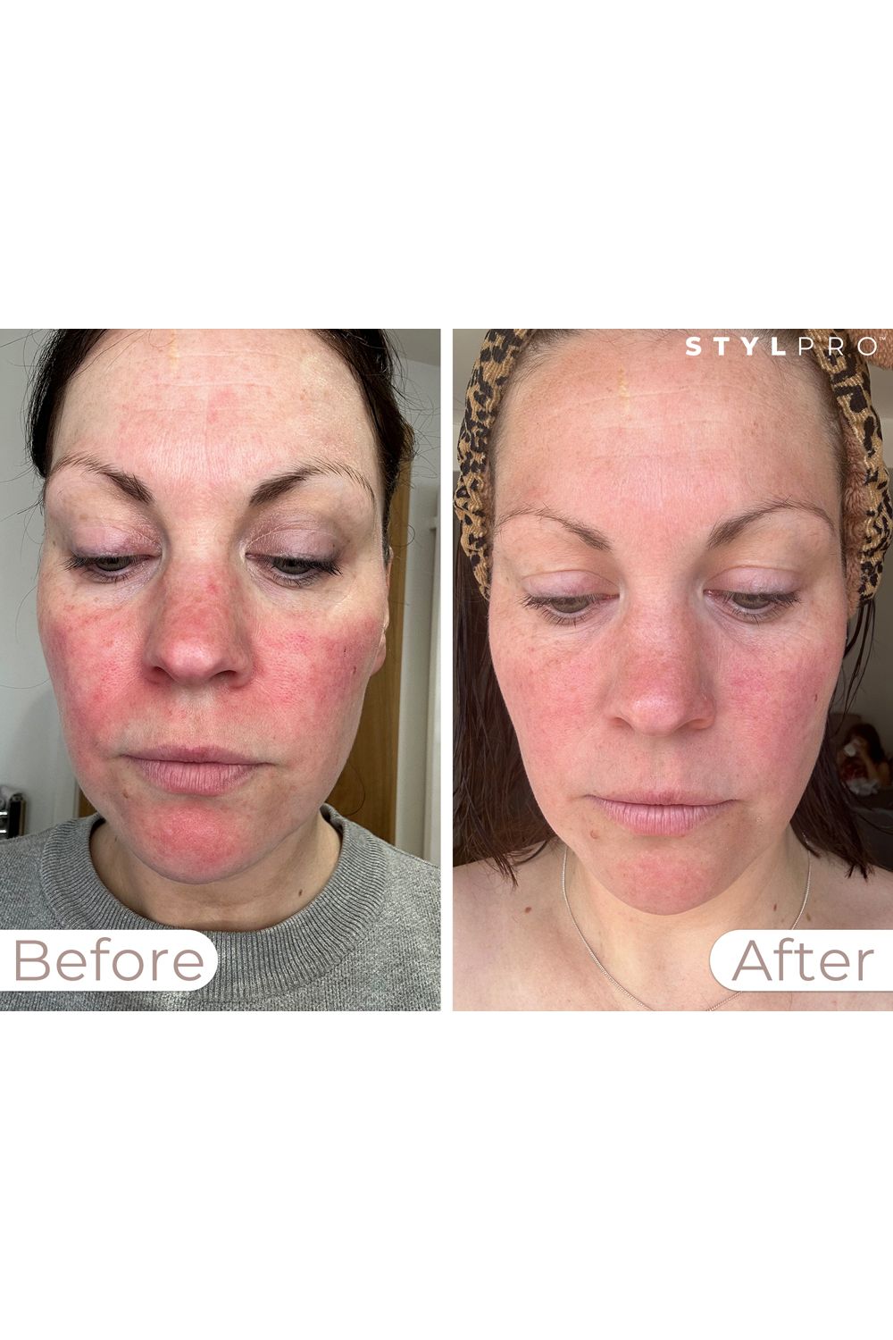 Stylpro LED Wavelength Face Mask Multi image 7