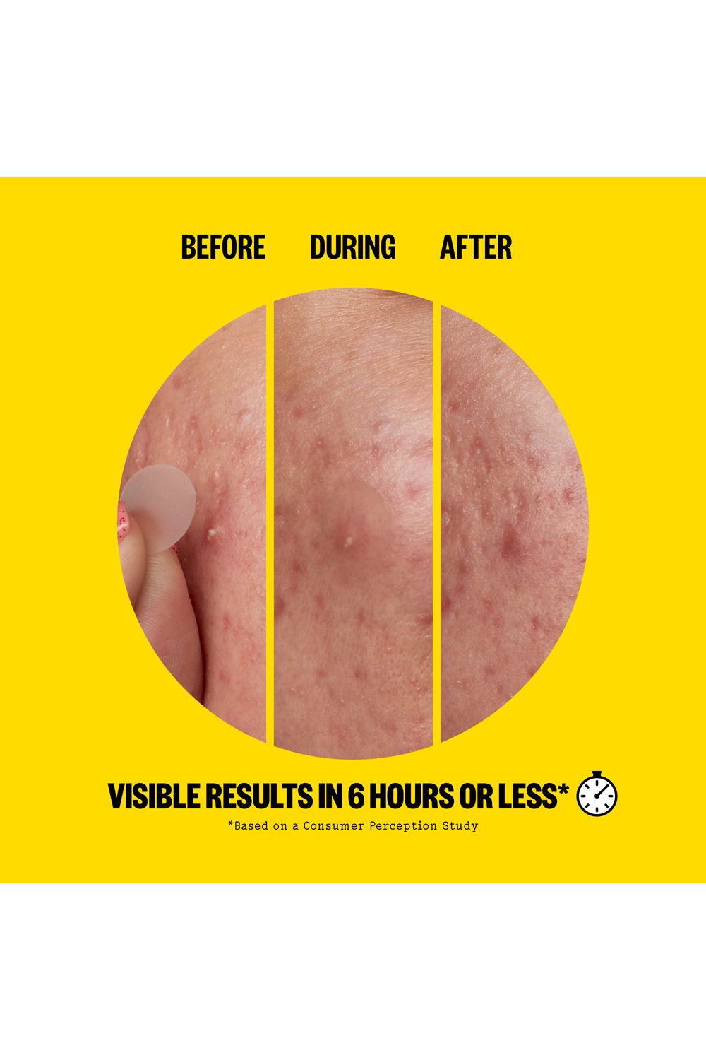 Peace Out Acne Day Dot - 20 Dots Multi image 6