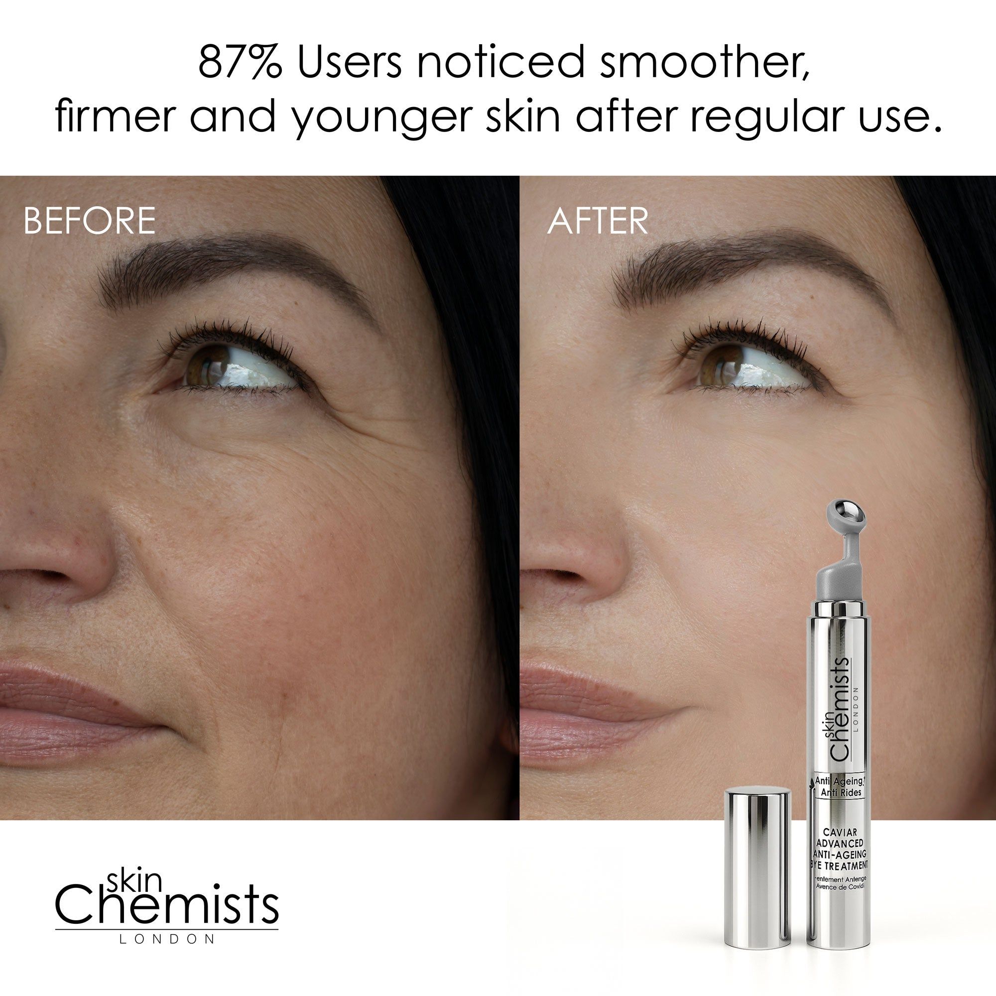 skinChemists professional Caviar Advanced Anti-Ageing Eye Treatment 15ml image 4