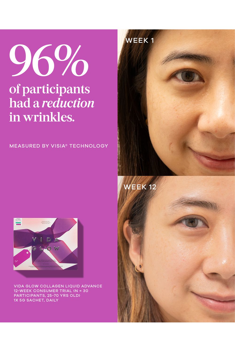 Vida Glow Super Skin Set Multi image 4