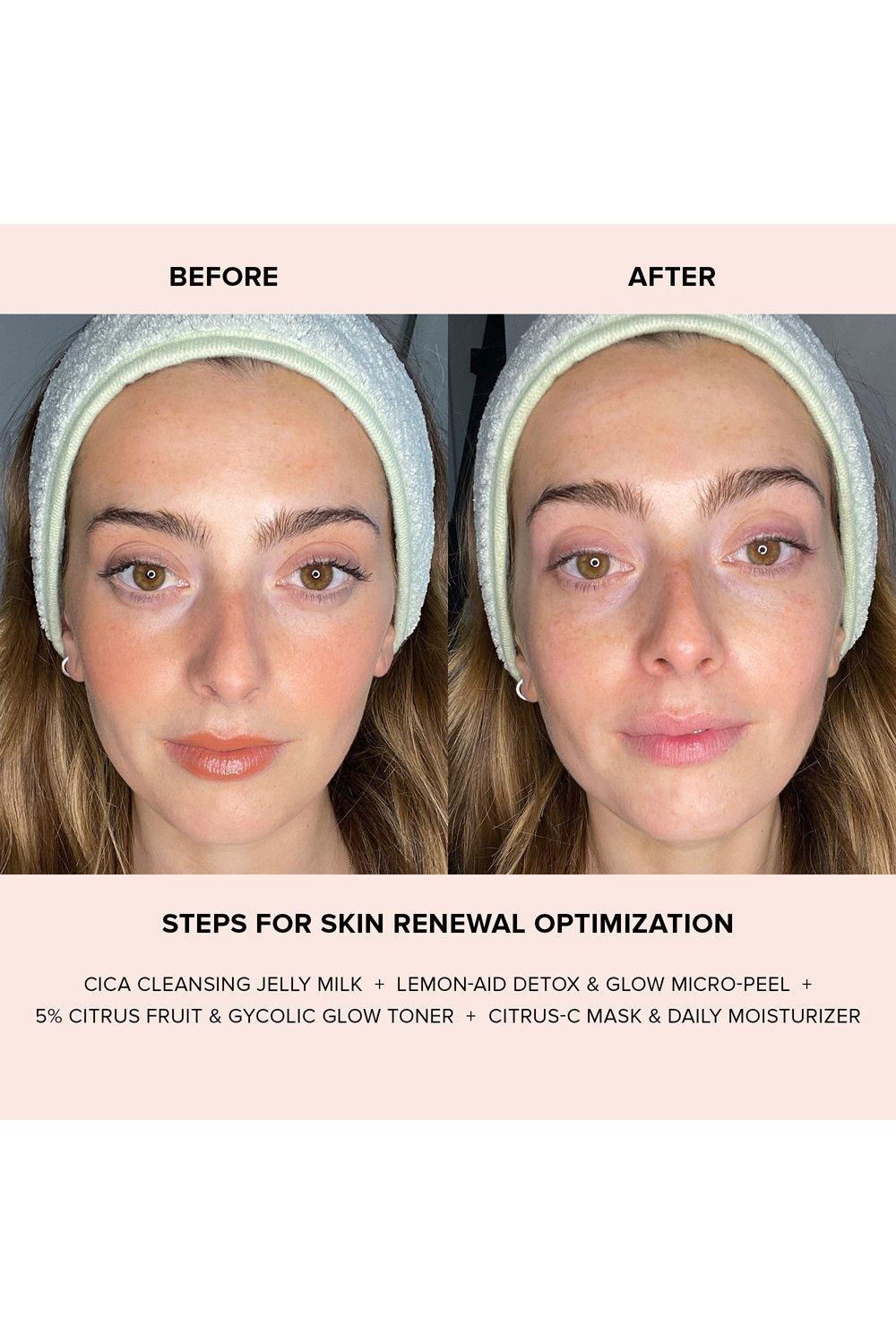 Nudestix Cica Cleansing Jelly Milk Multi image 3