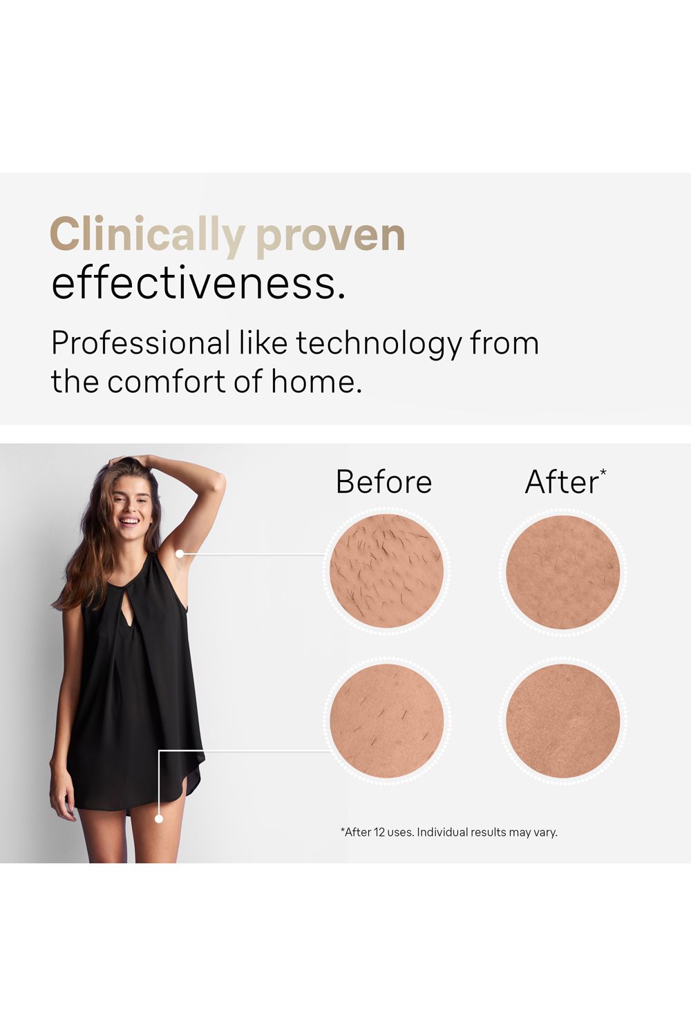 Braun IPL5347 Permanent Hair Removal Multi image 6