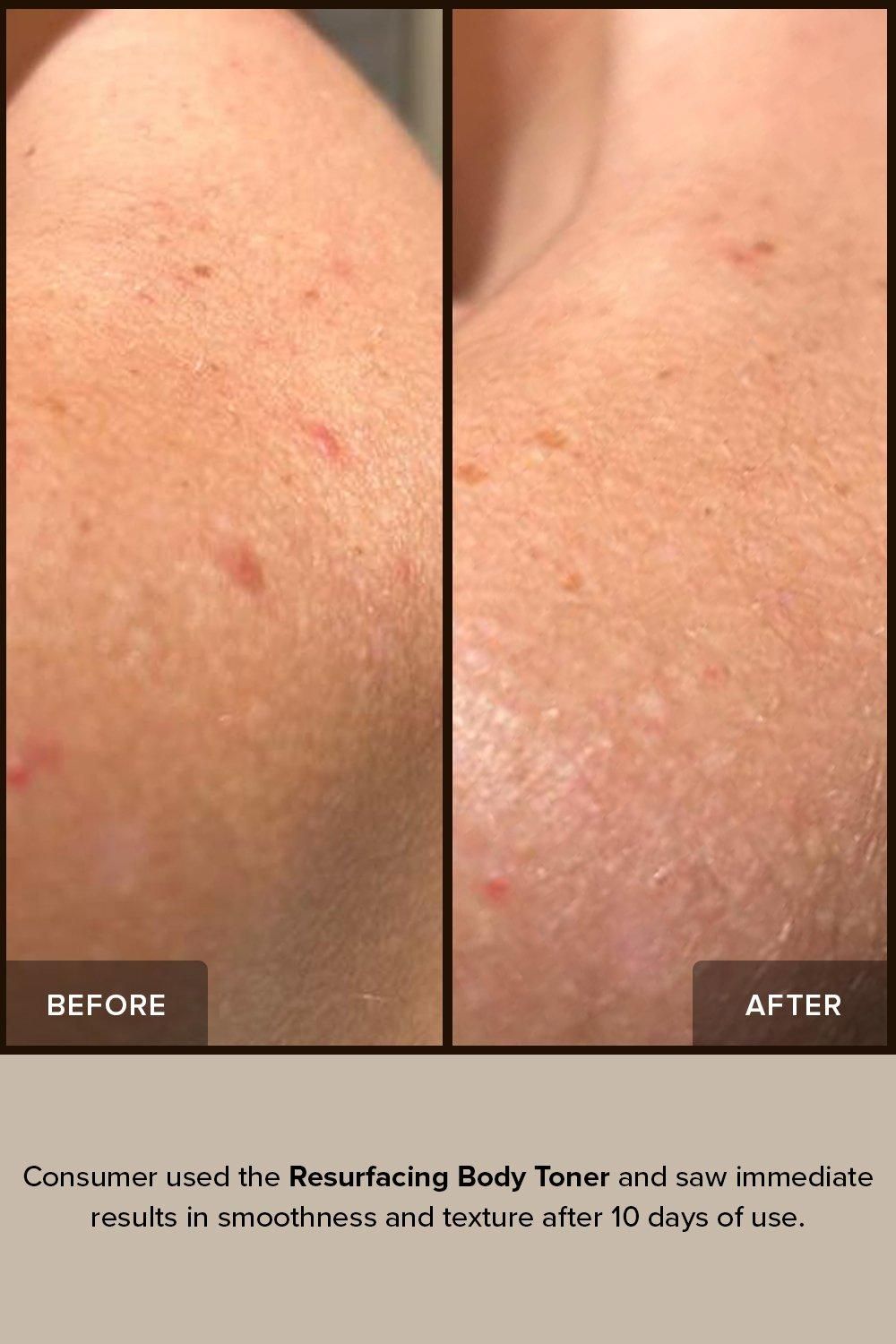 Nudestix Resurfacing Body Toner Multi image 3
