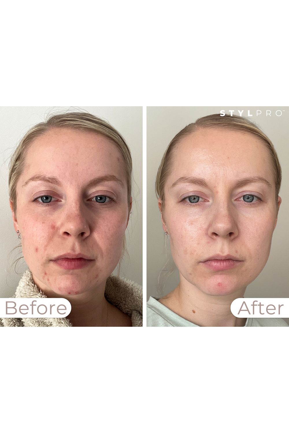 Stylpro LED Wavelength Face Mask Multi image 10