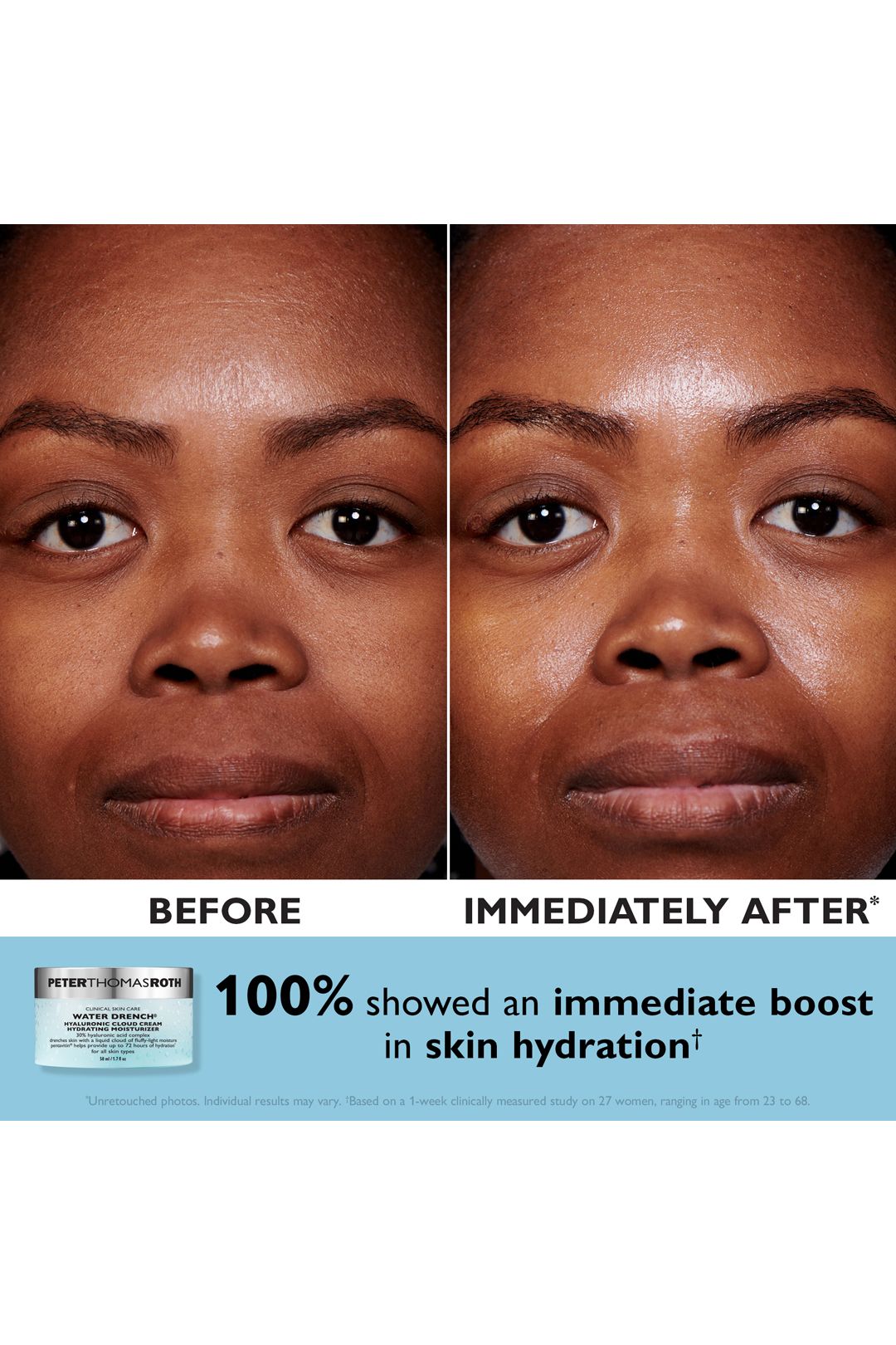 Peter Thomas Roth Holiday Kit - Waterdrench Mini Day & Night Cloud Creams 40ml Gift Set Multi image 3