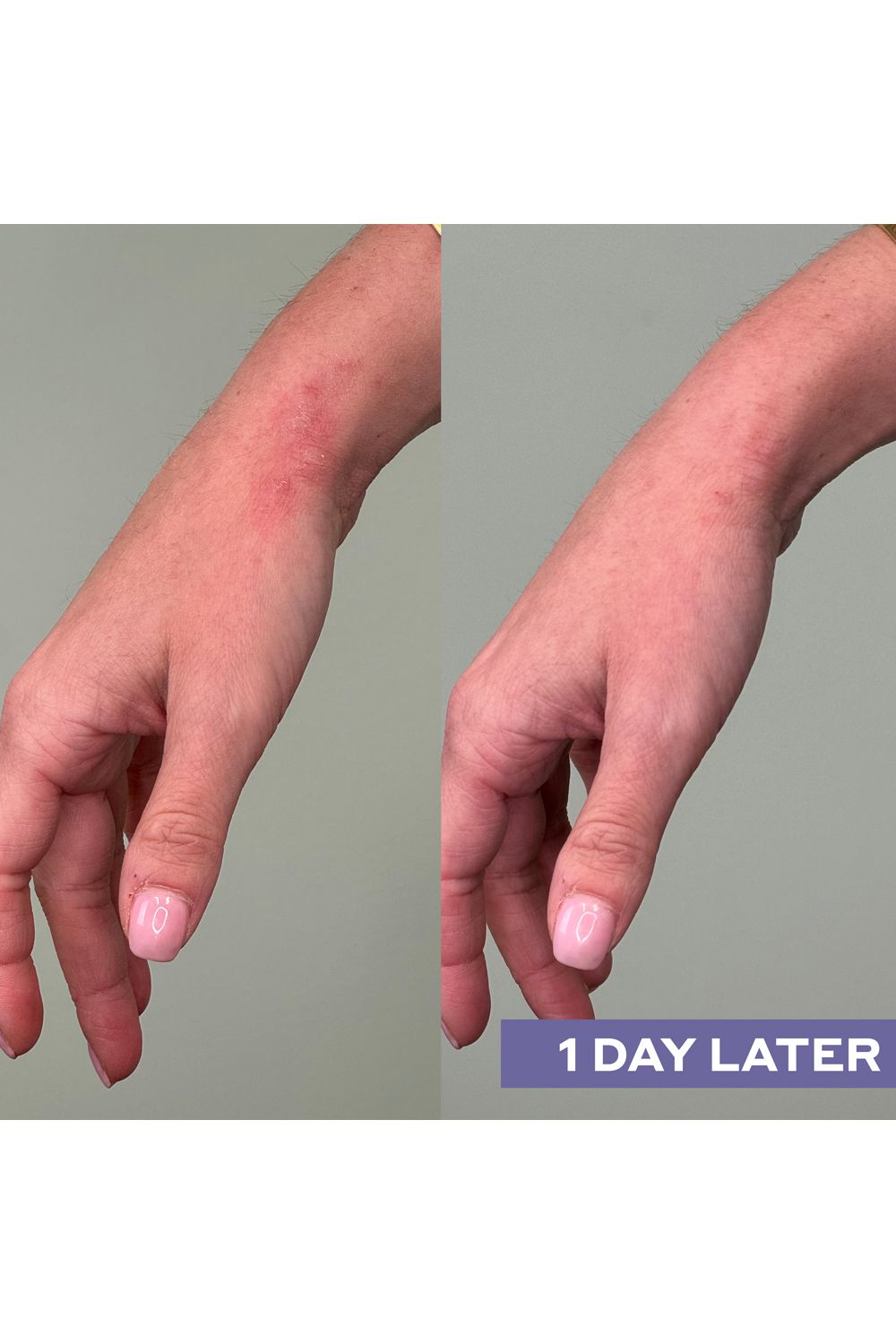 Mario Badescu Repairing Facial Spray With Hypochlorous Acid Multi image 2