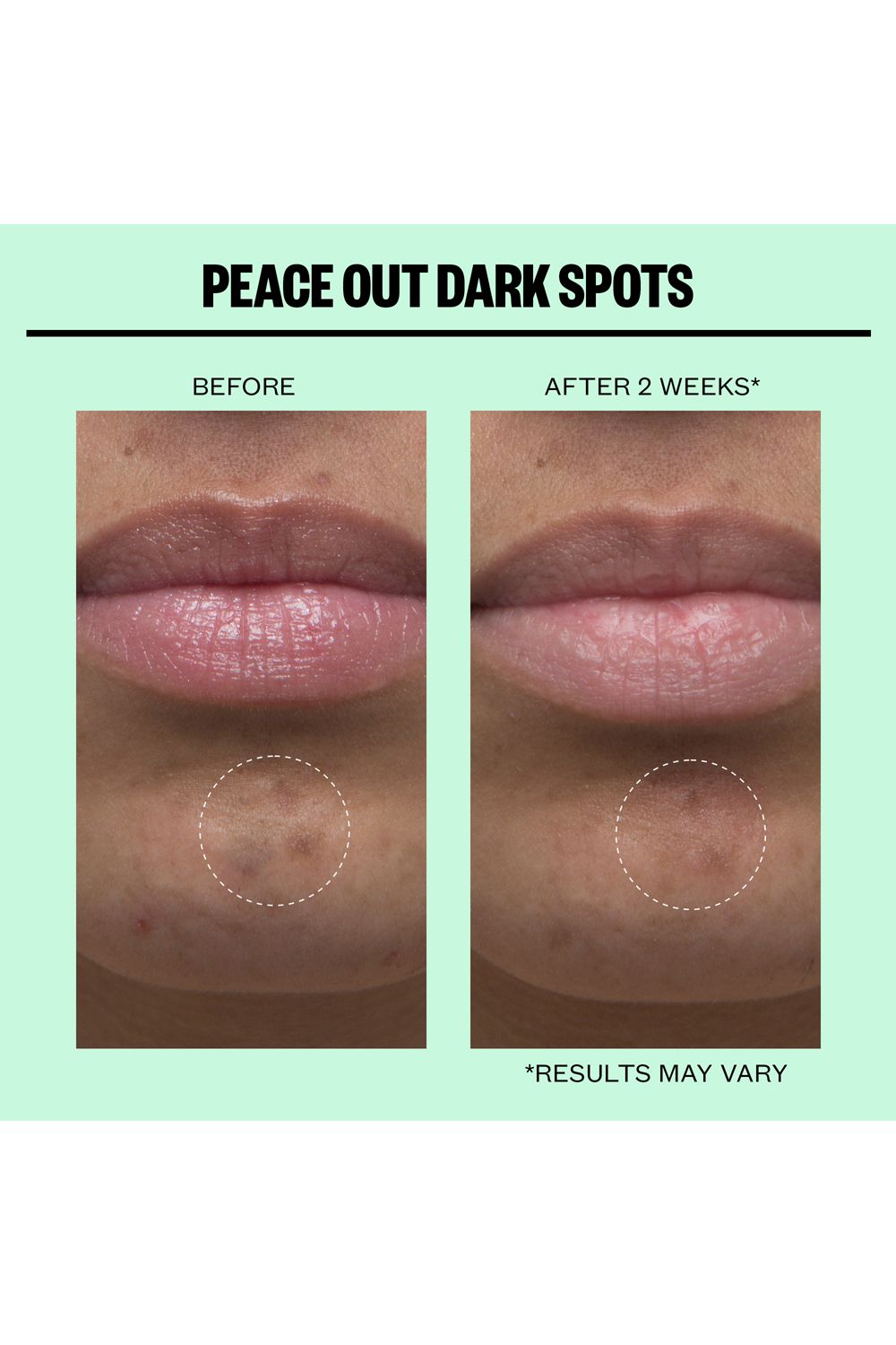 Peace Out Dark Spots - 12 Dots Multi image 6
