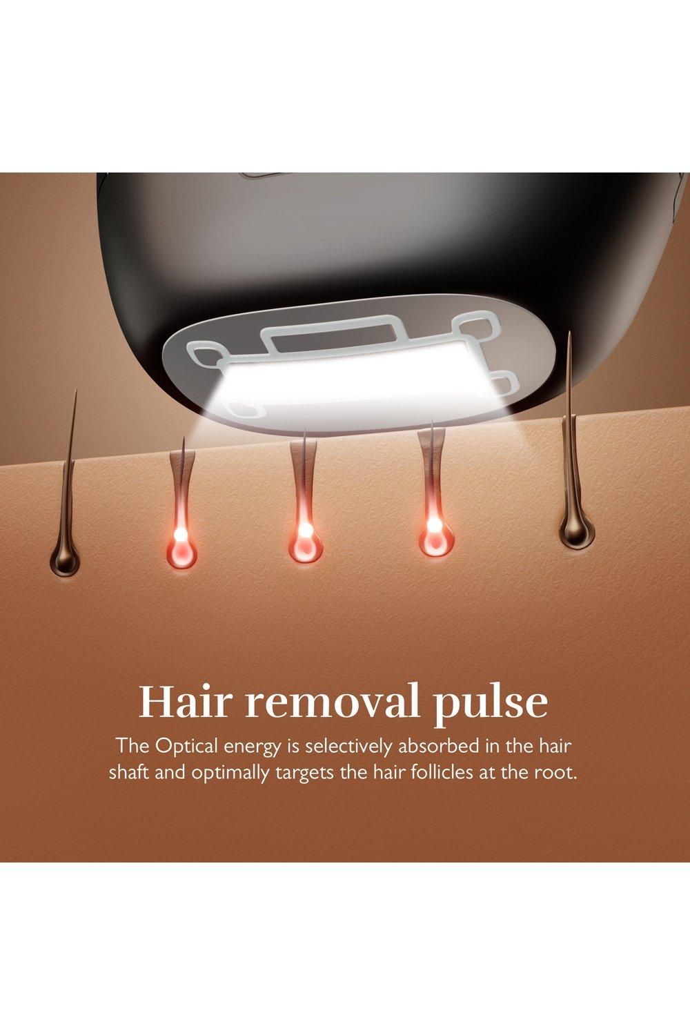 Silk'n Silkn 7 - IPL device with rotatable head Black image 7