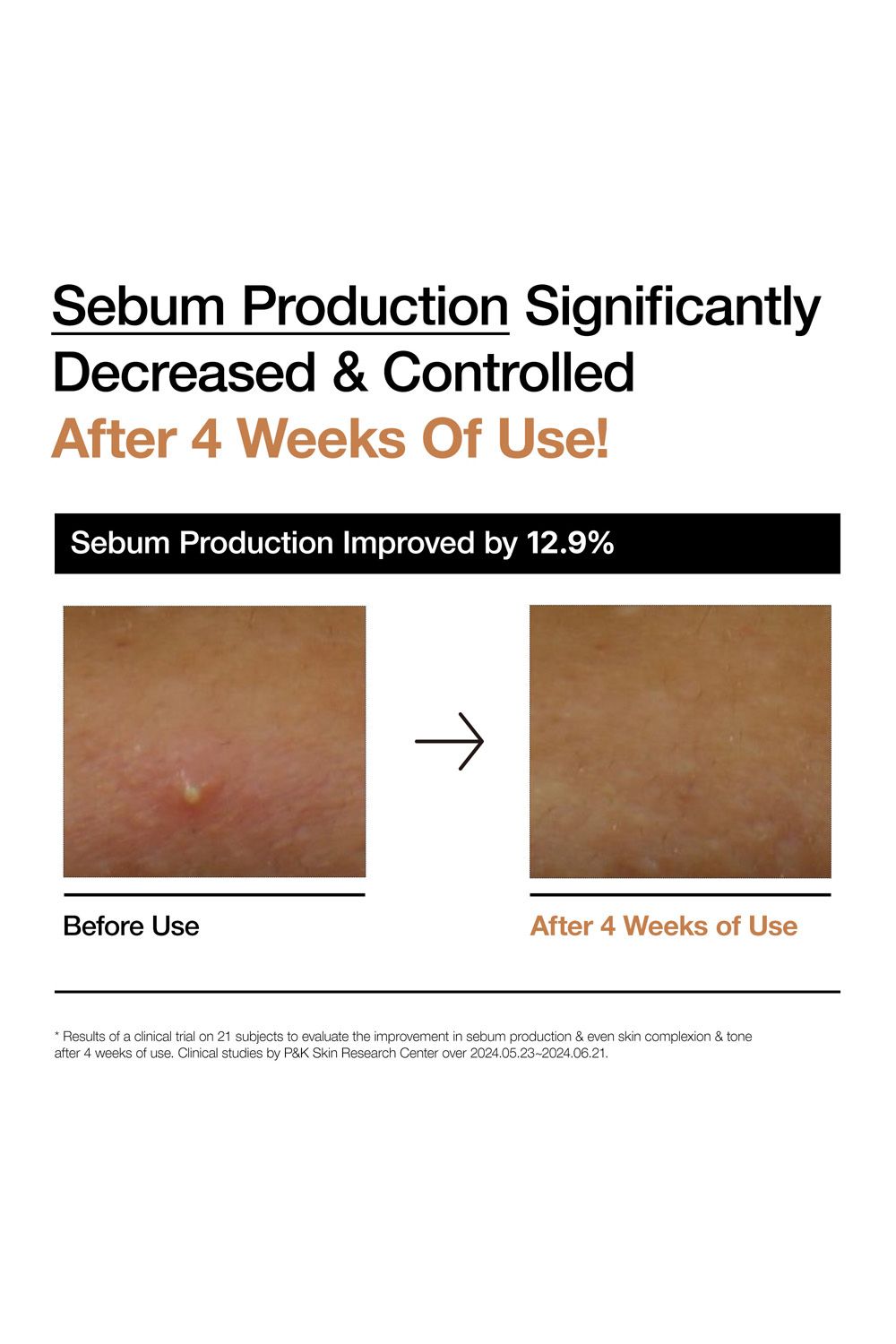 Anua Rice 70 Glow Milky Toner 250ml Multi image 6