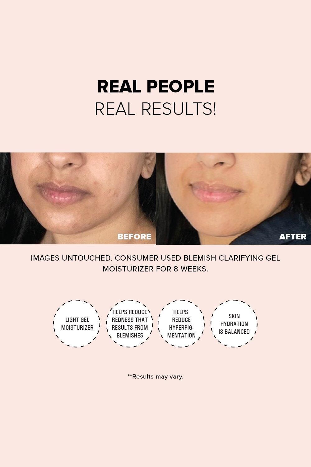 Nudestix Blemish Clarifying Gel Mosturiser Multi image 3