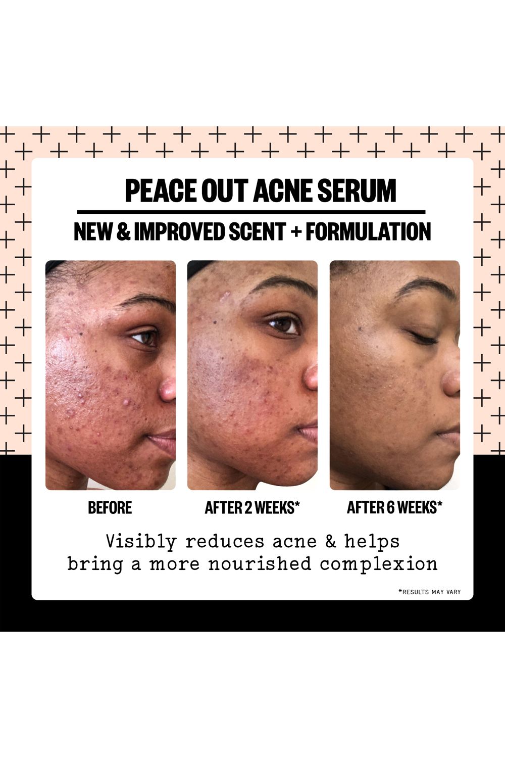 Peace Out Acne Cleanser 50ml Multi image 8