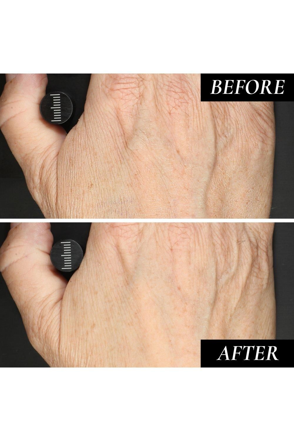 Kaplan MD Diamond Contour Anti-Aging Hand Treatment 90ml Multi image 3