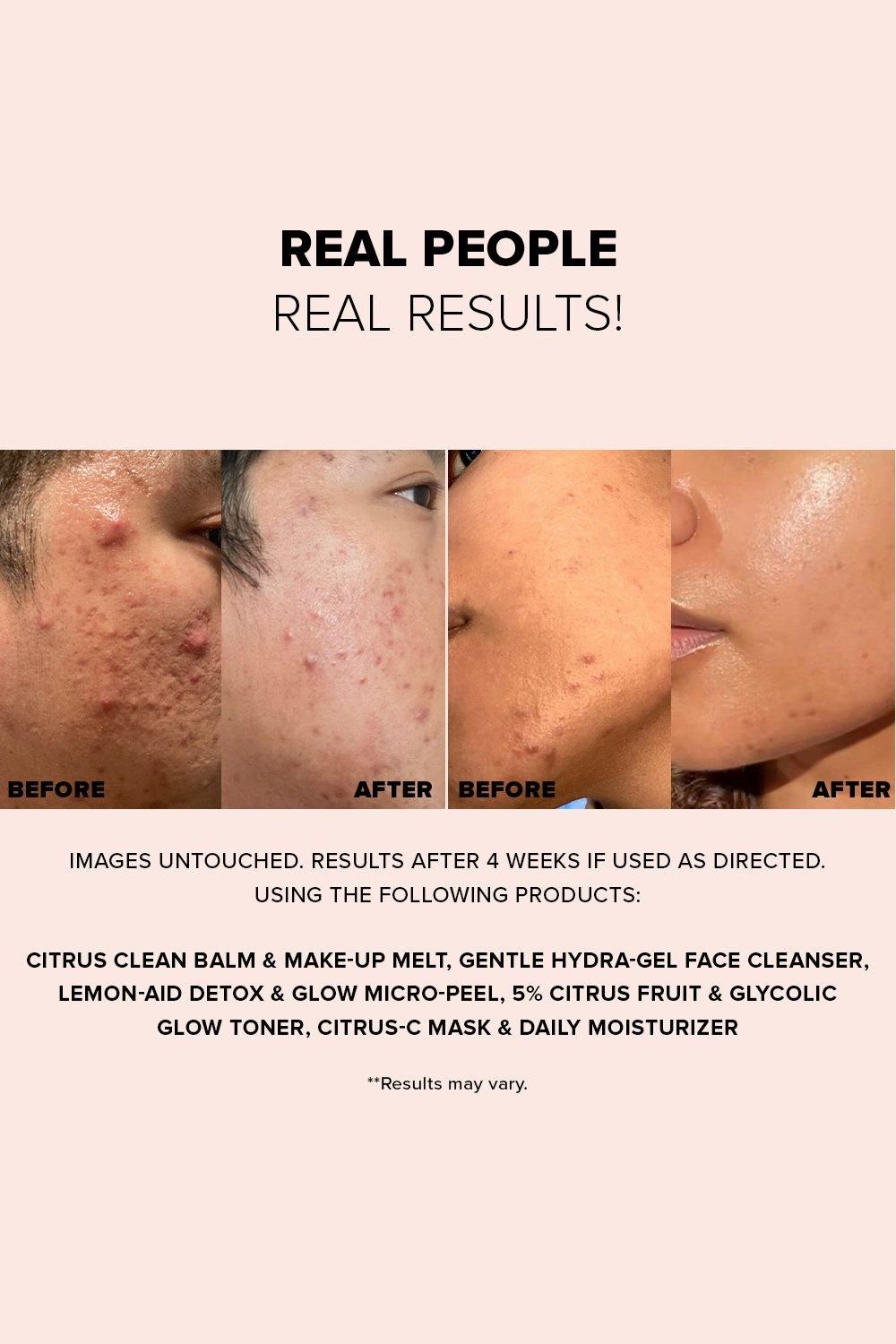 Nudestix Nudeskin Gentle Hydra-Gel Face Cleanser 70ml Multi image 5