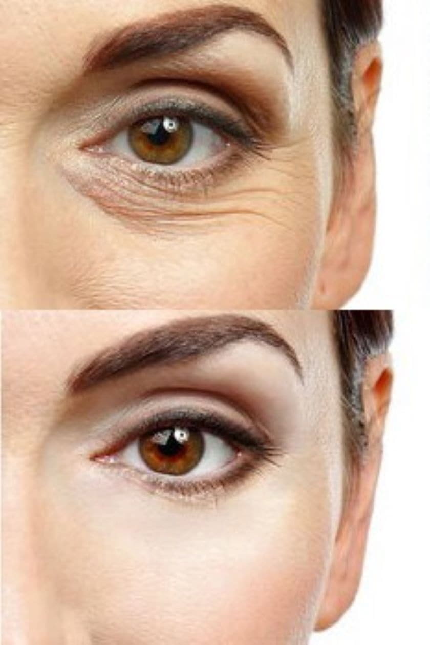 StarGate ClearSkin Glow II LED Mask Reduce Wrinkles & Boost Anti-Ageing Glow image 3