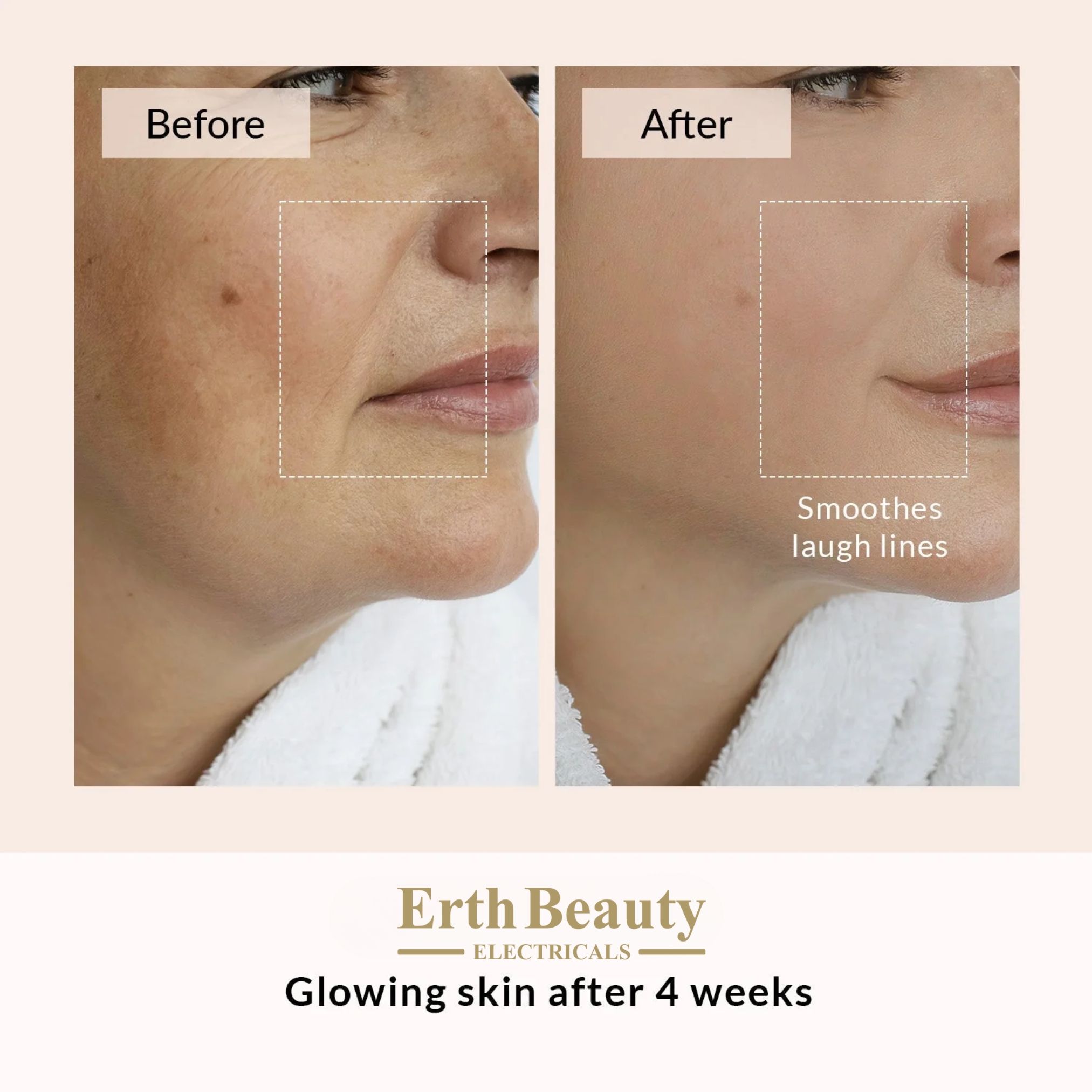 Erth Skin London 7 LED Colour Face + Neck Mask - Limited Edition image 7