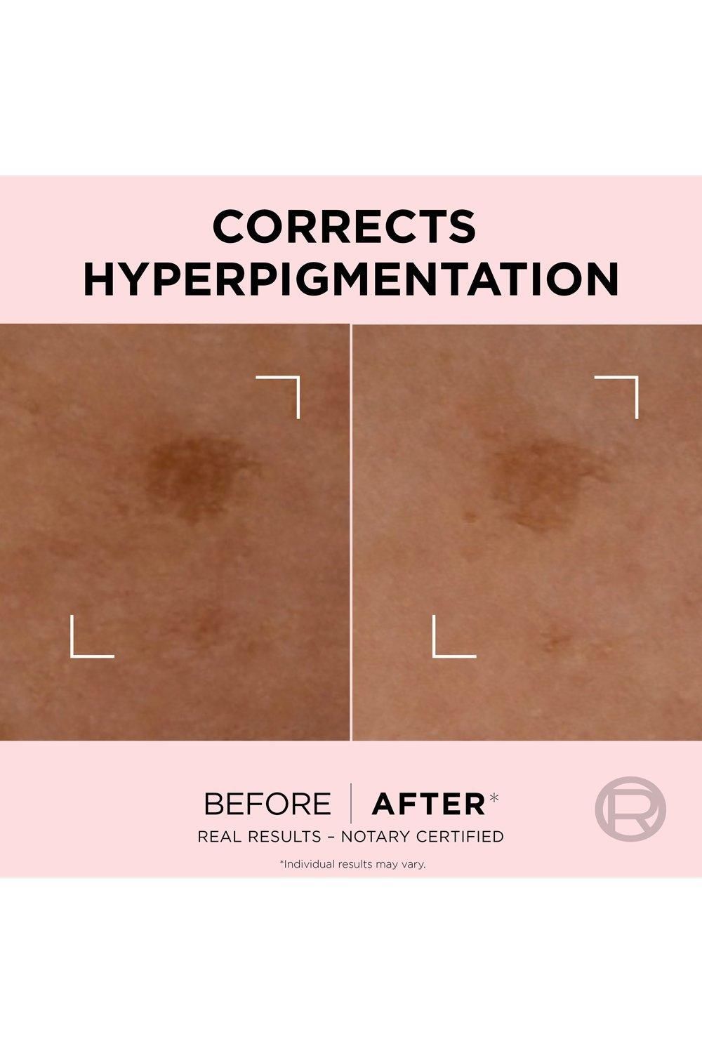 L'Oréal Paris Age Perfect Golden Age Rapid Spot Corrector, Niacinamide Multi image 4