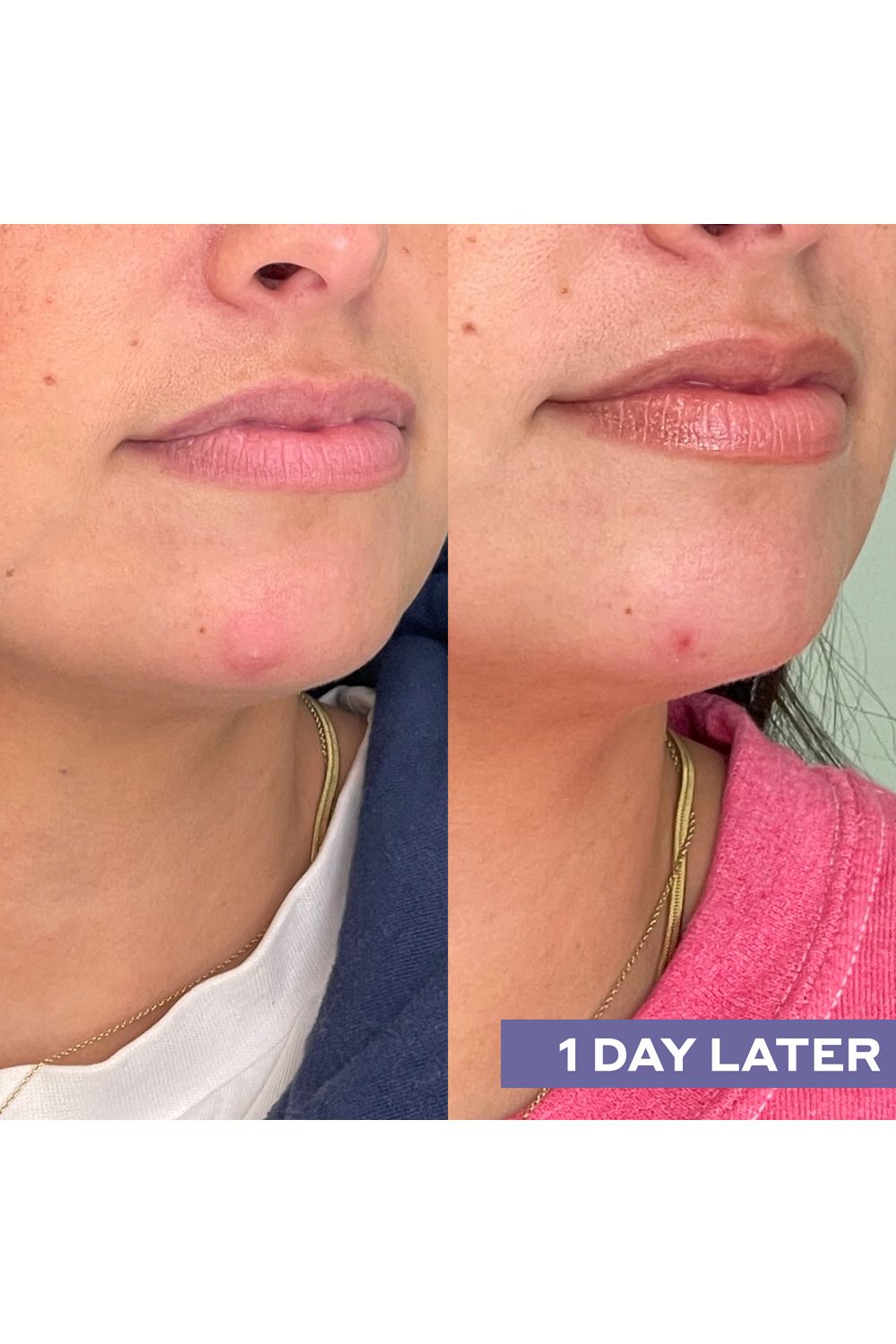 Mario Badescu Repairing Facial Spray With Hypochlorous Acid Multi image 9