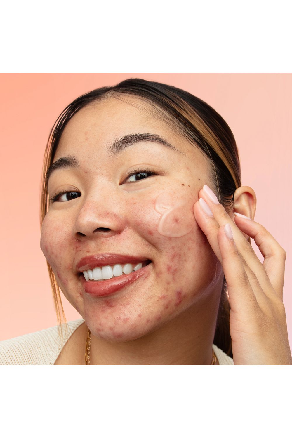 Peace Out Acne Moisturiser with 2% Salicylic Acid 50ml Multi image 9