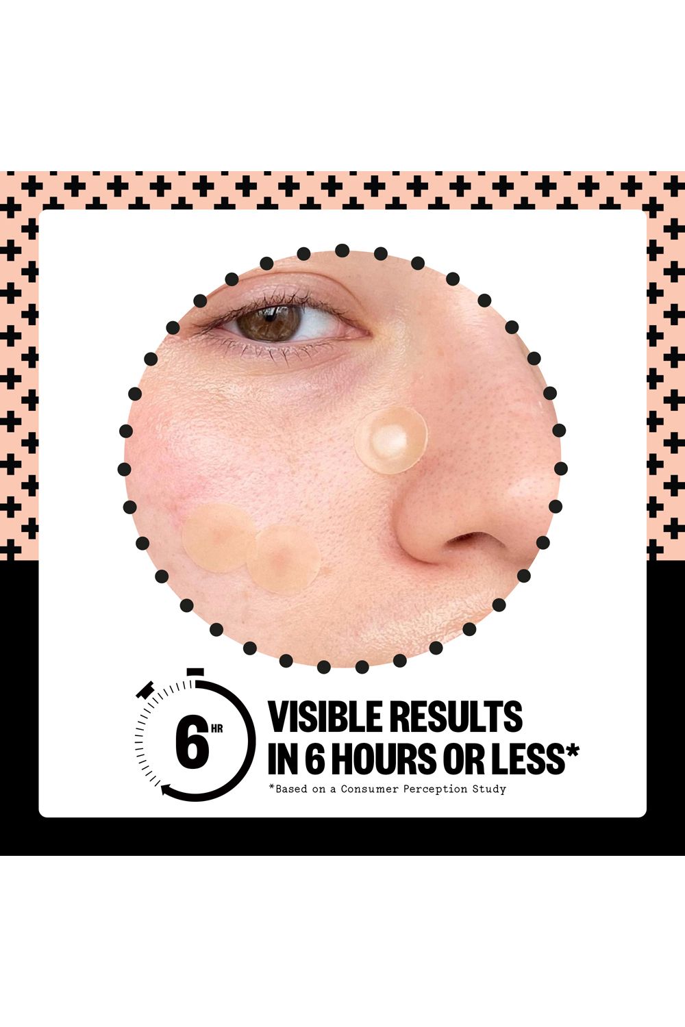 Peace Out Acne Dots - 20 Dots Multi image 7