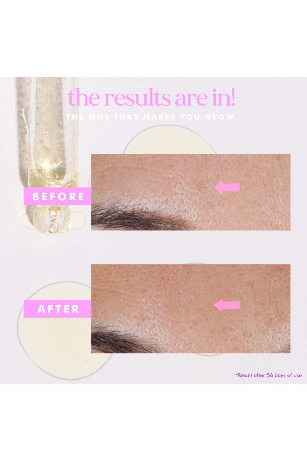 Hellosunday The One That Makes You Glow - SPF40 Hyperpigmentation Treatment Serum Multi image 6