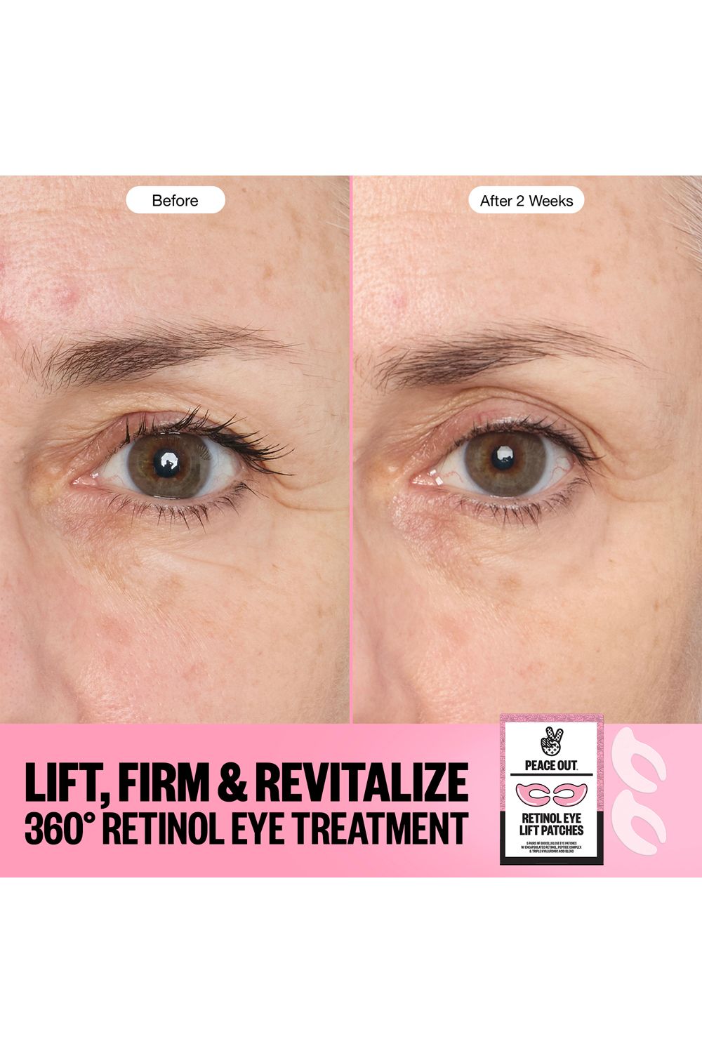 Peace Out Retinol Eye Lift Patches -5 Pairs Multi image 5