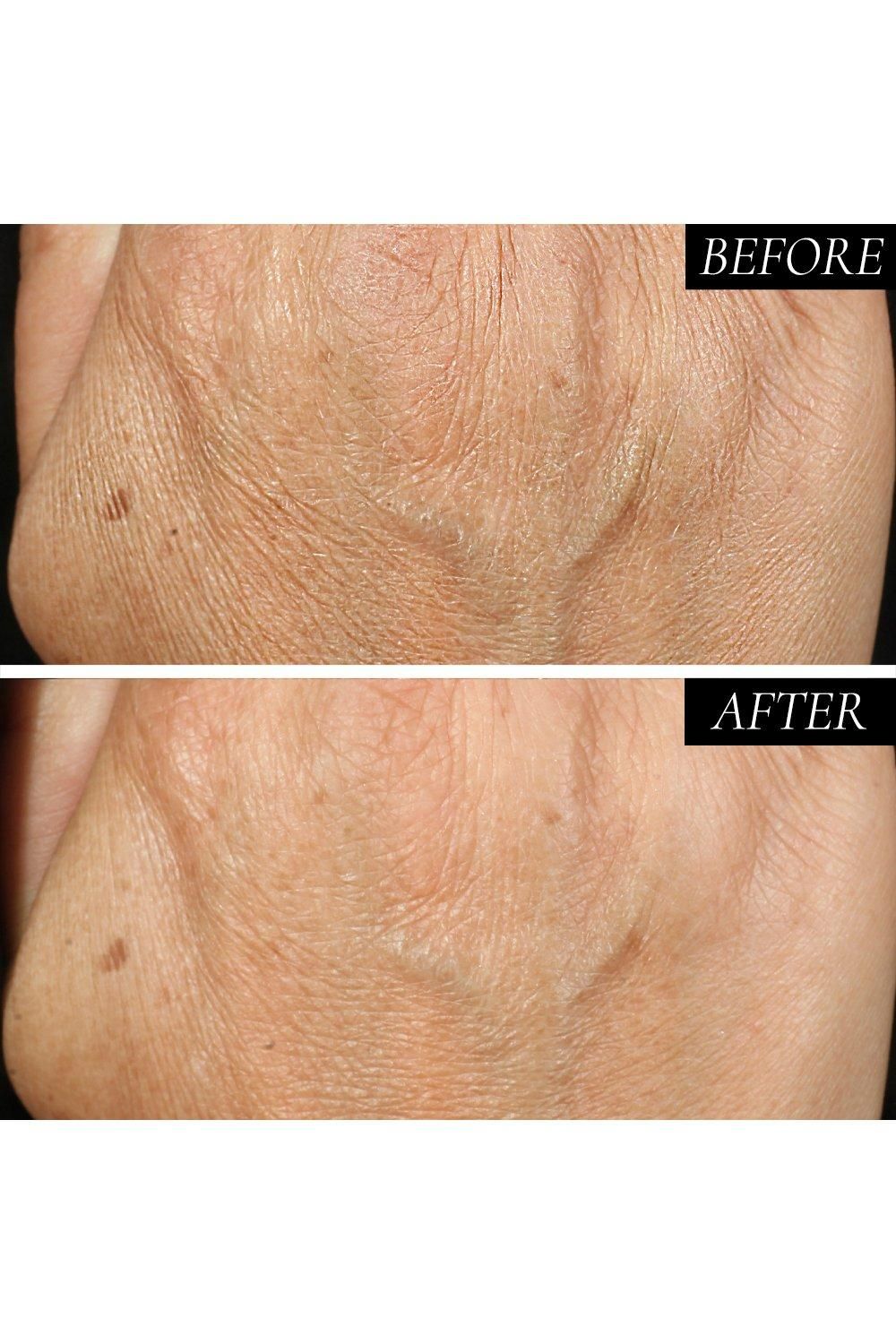 Kaplan MD Diamond Contour Anti-Aging Hand Treatment 90ml Multi image 6