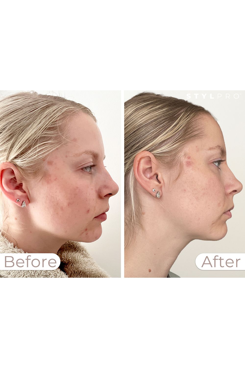 Stylpro LED Wavelength Face Mask Multi image 9