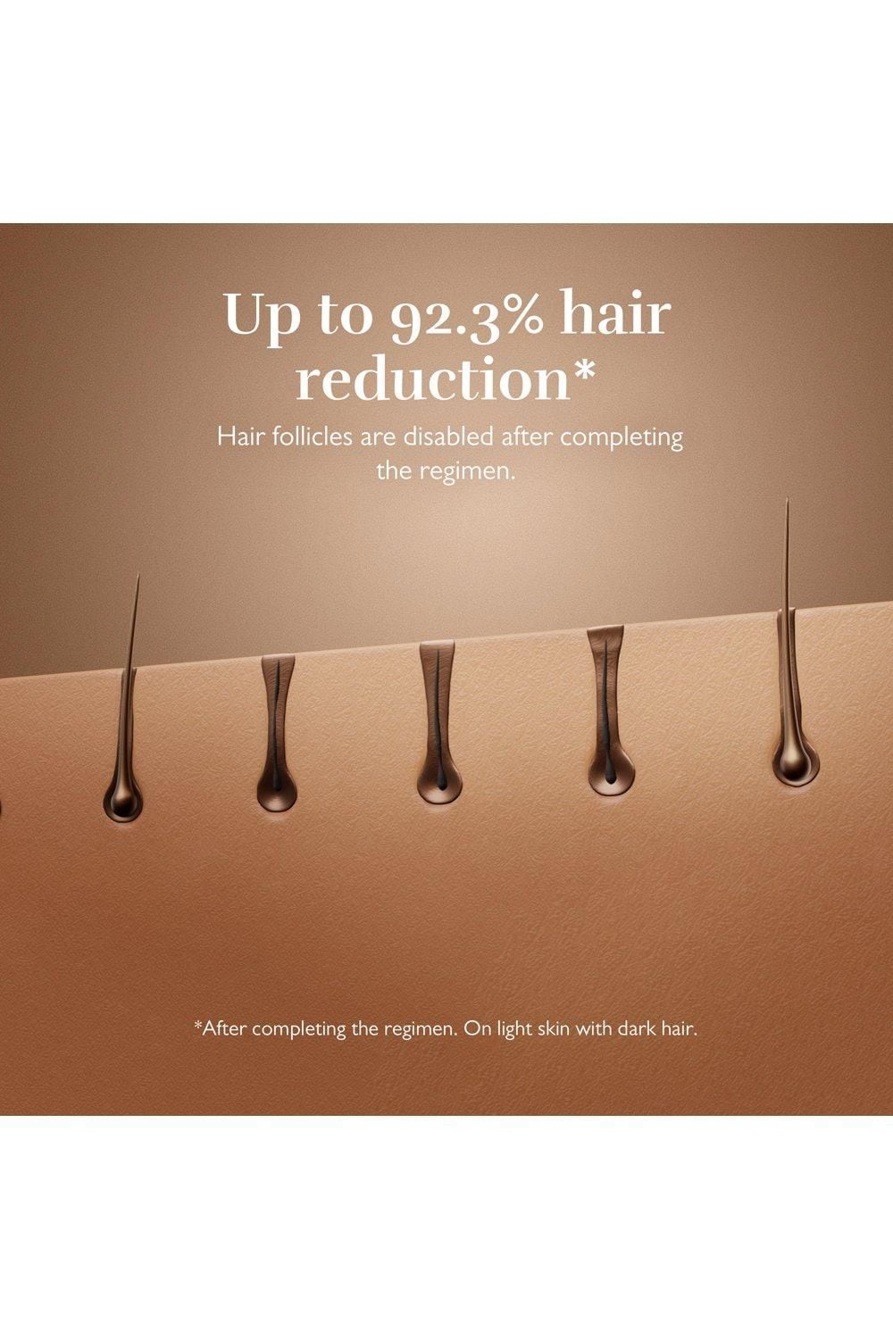 Silk'n Silkn 7 - IPL device with rotatable head Black image 8