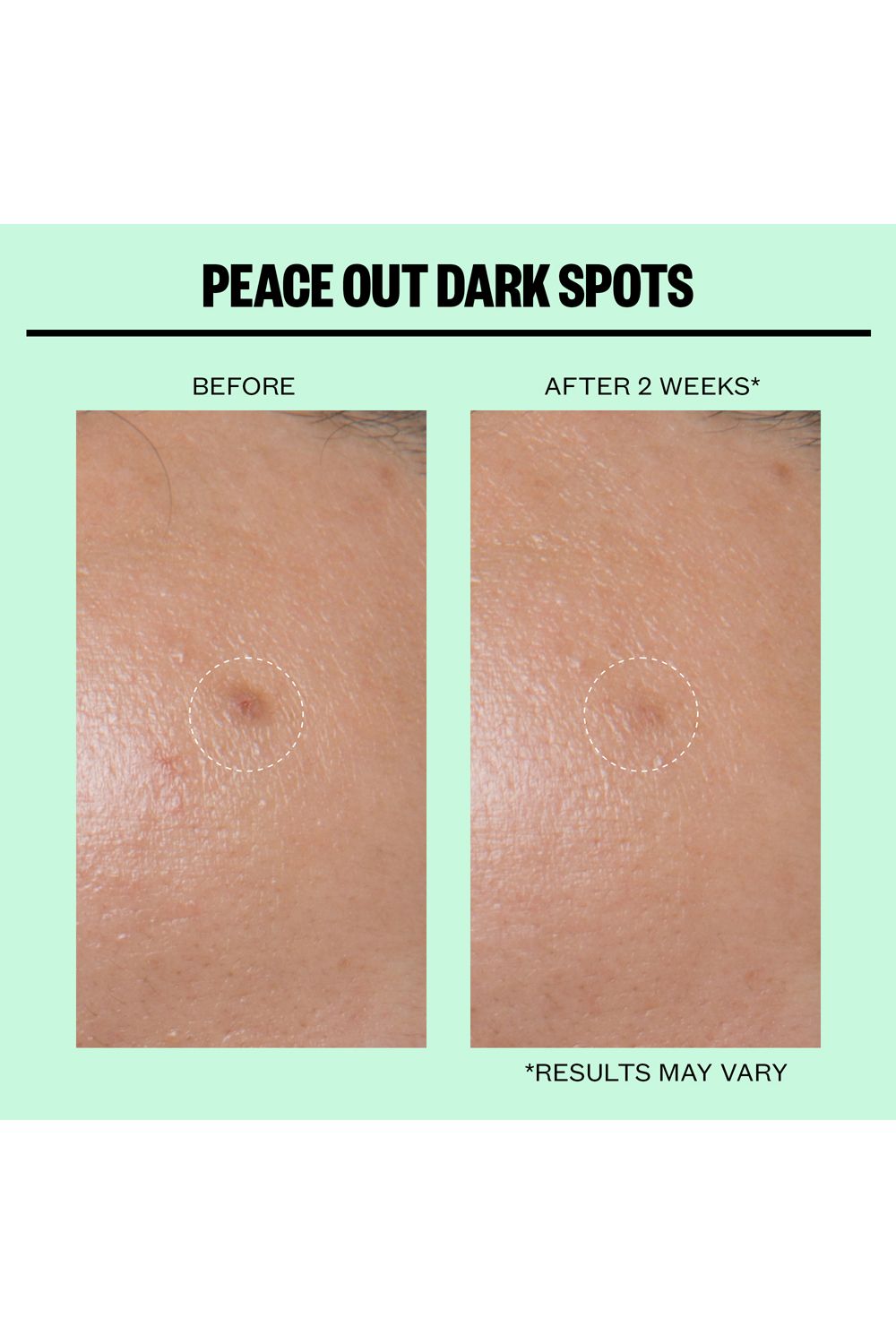 Peace Out Dark Spots - 12 Dots Multi image 7