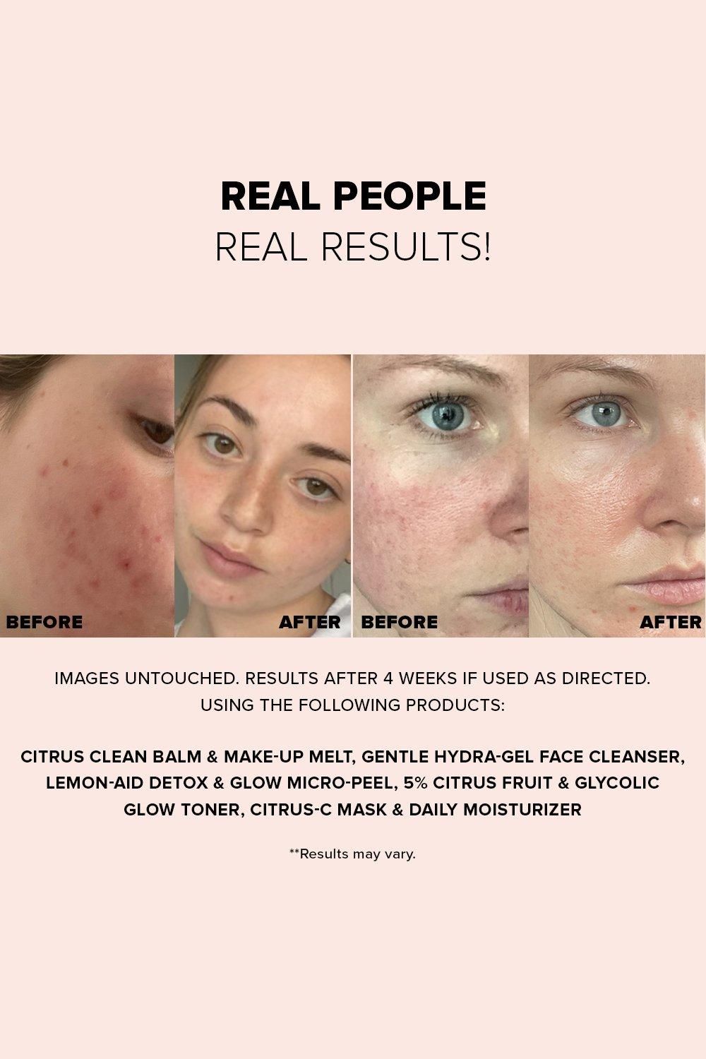 Nudestix Nudeskin Lemon-Aid Detox & Glow Micro-Peel Multi image 3